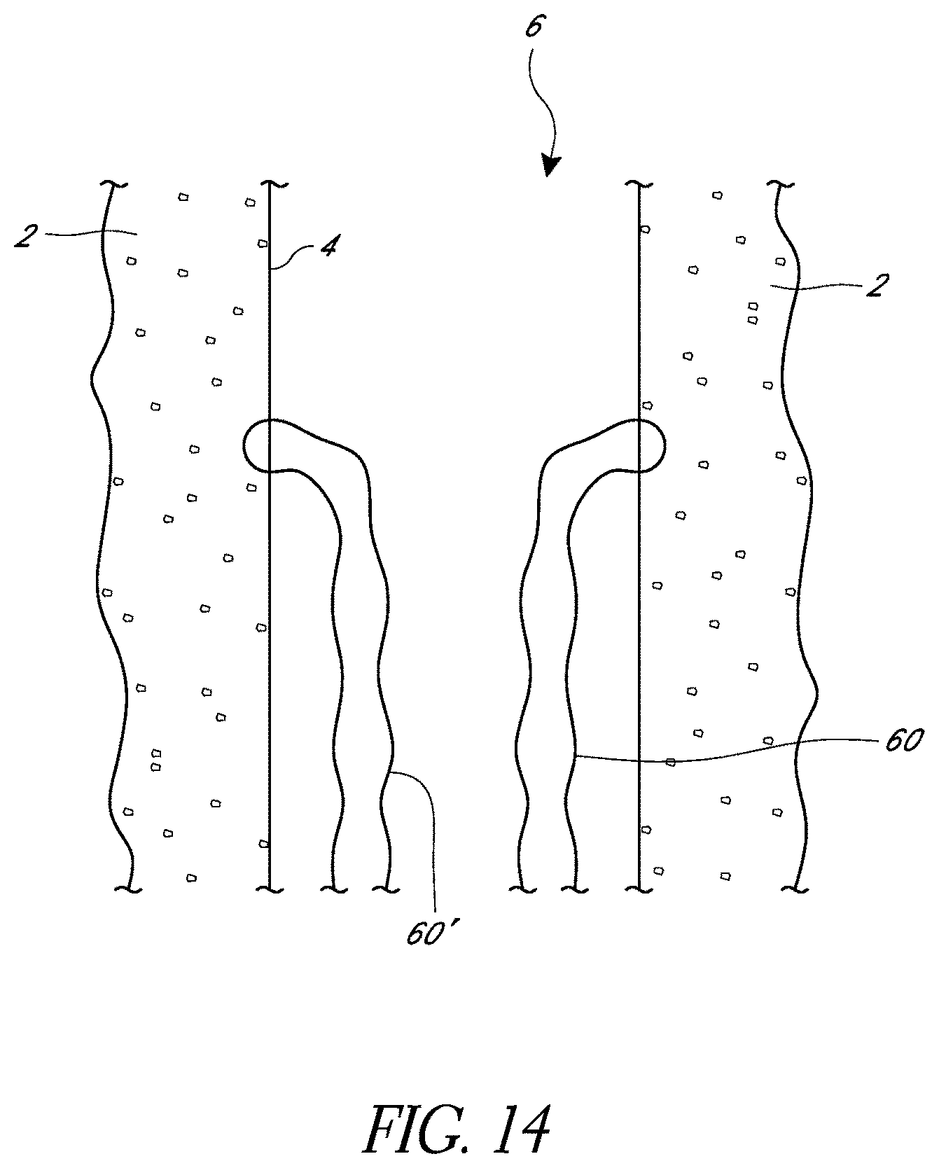 Patent US11779324 Figure 14 – Suturing methods and apparatuses