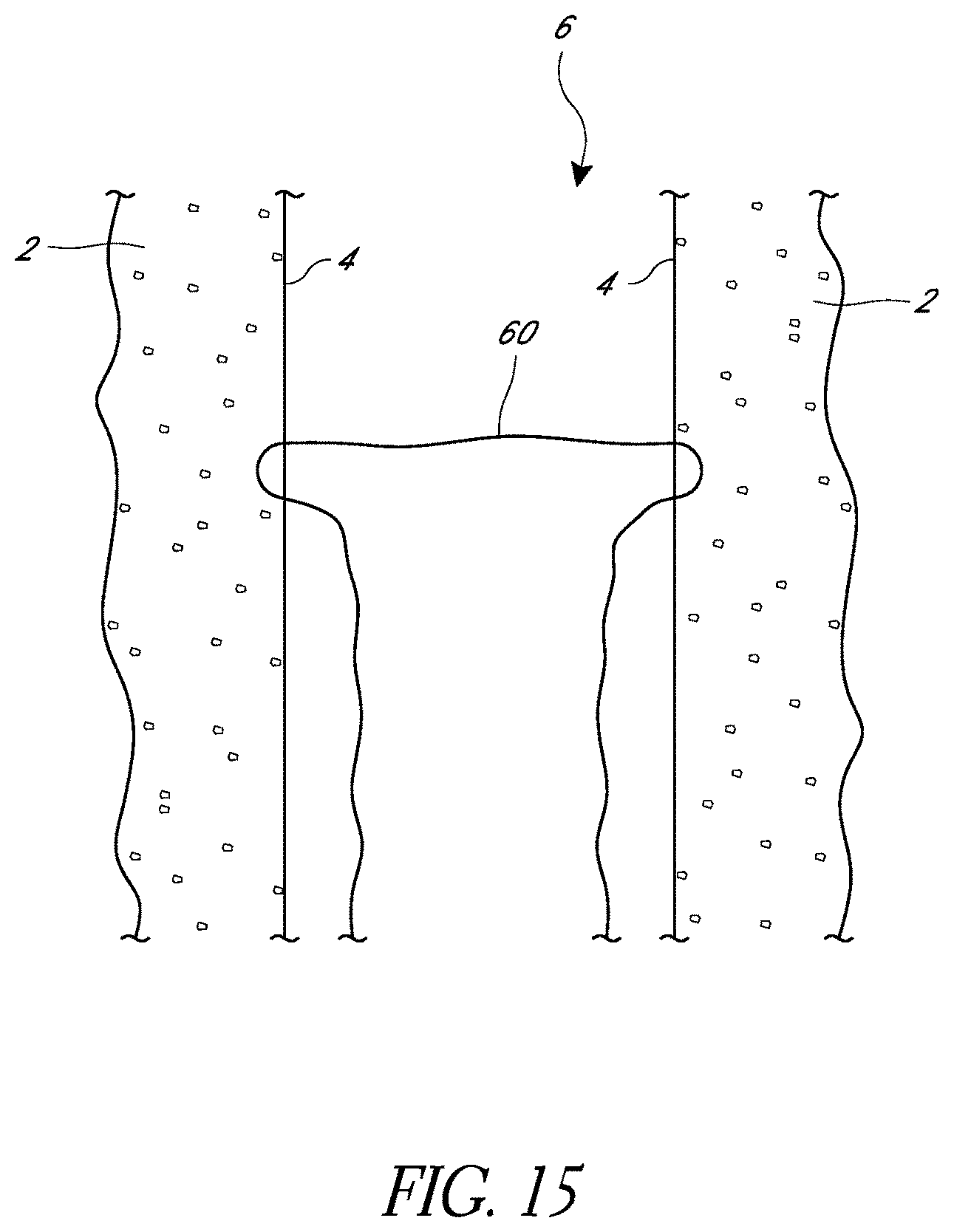 Patent US11779324 Figure 15 – Suturing methods and apparatuses