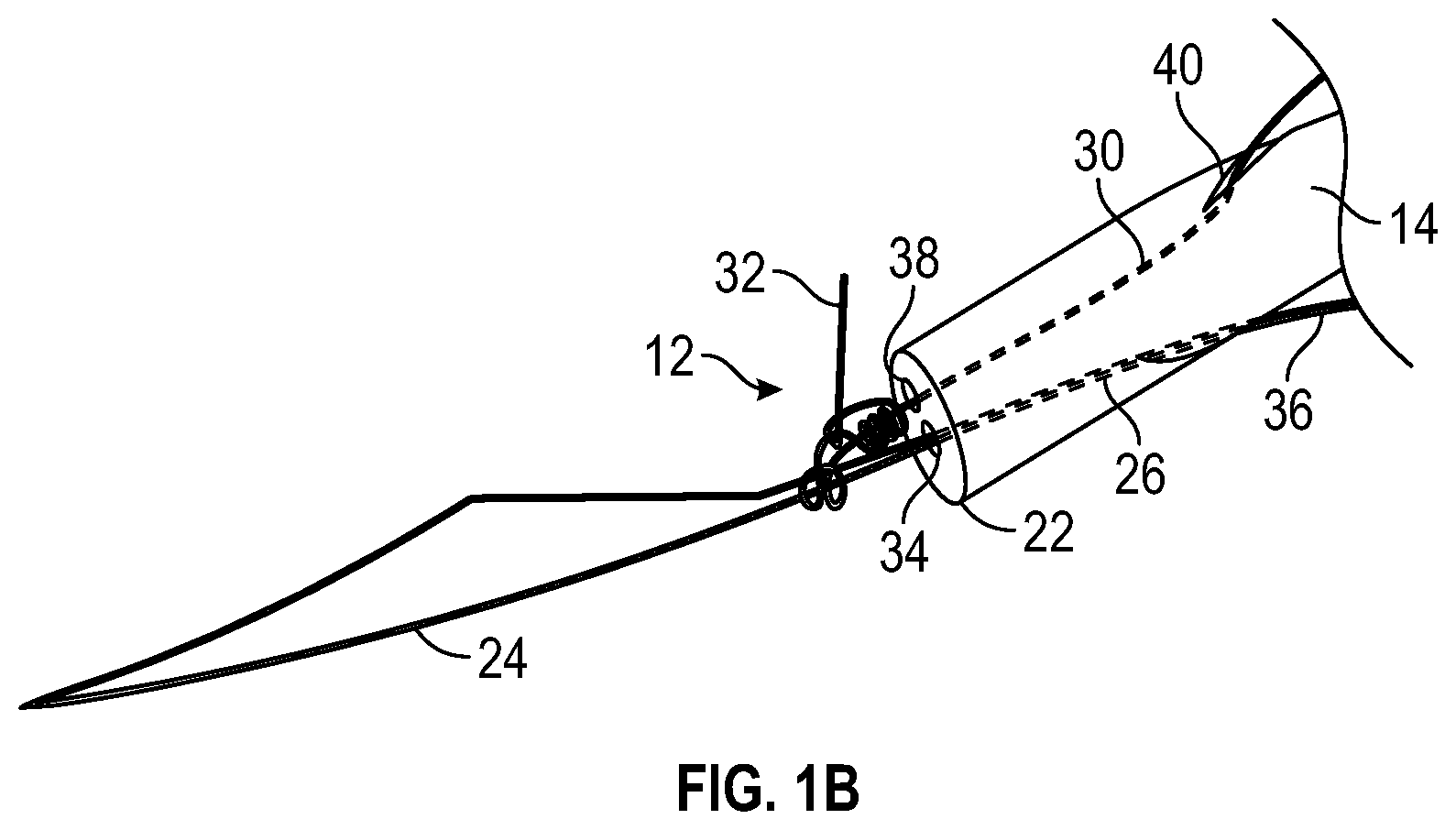 Patent US11779325 Figure 2 – Knot delivery device