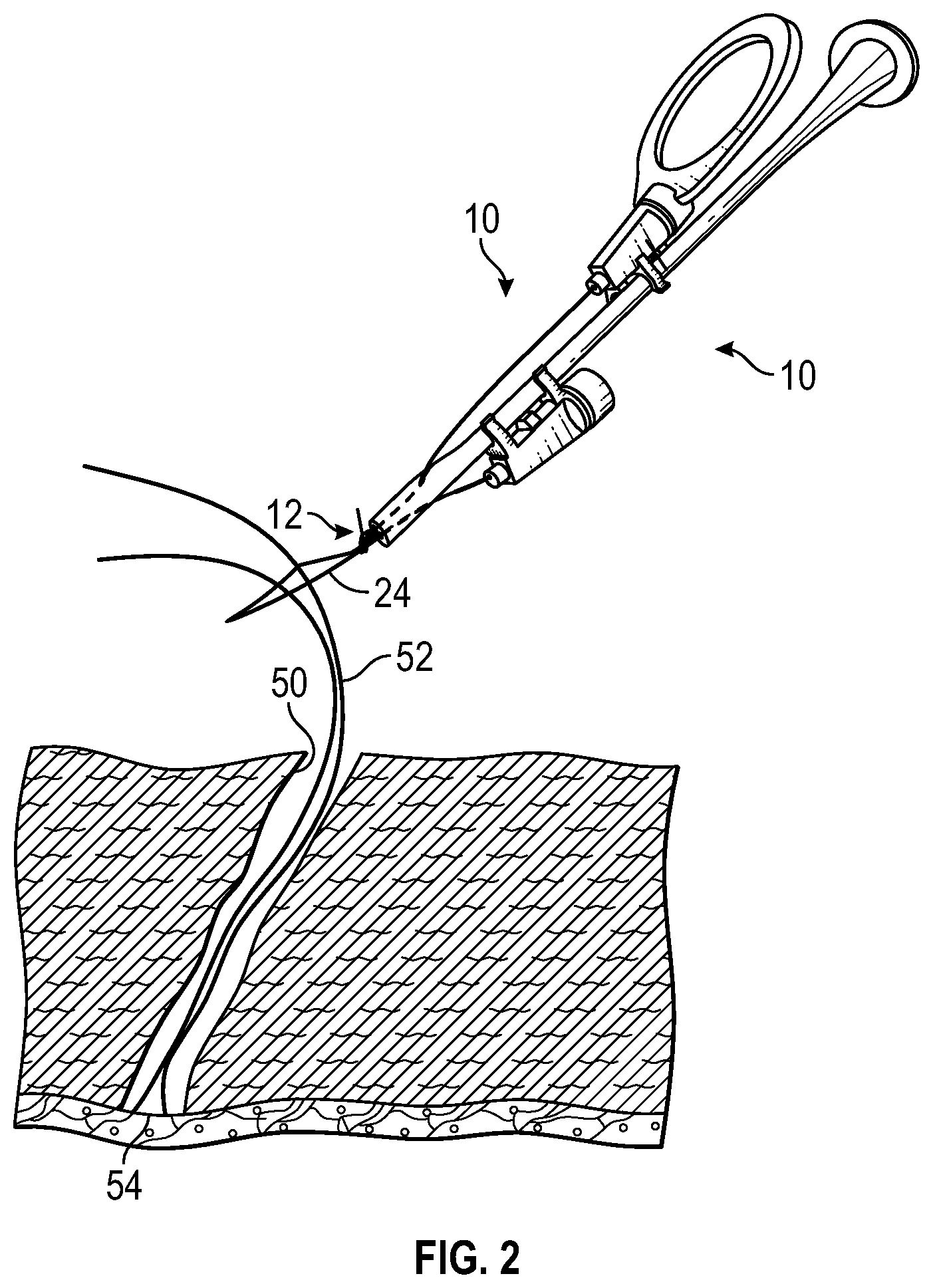 Patent US11779325 Figure 3 – Knot delivery device