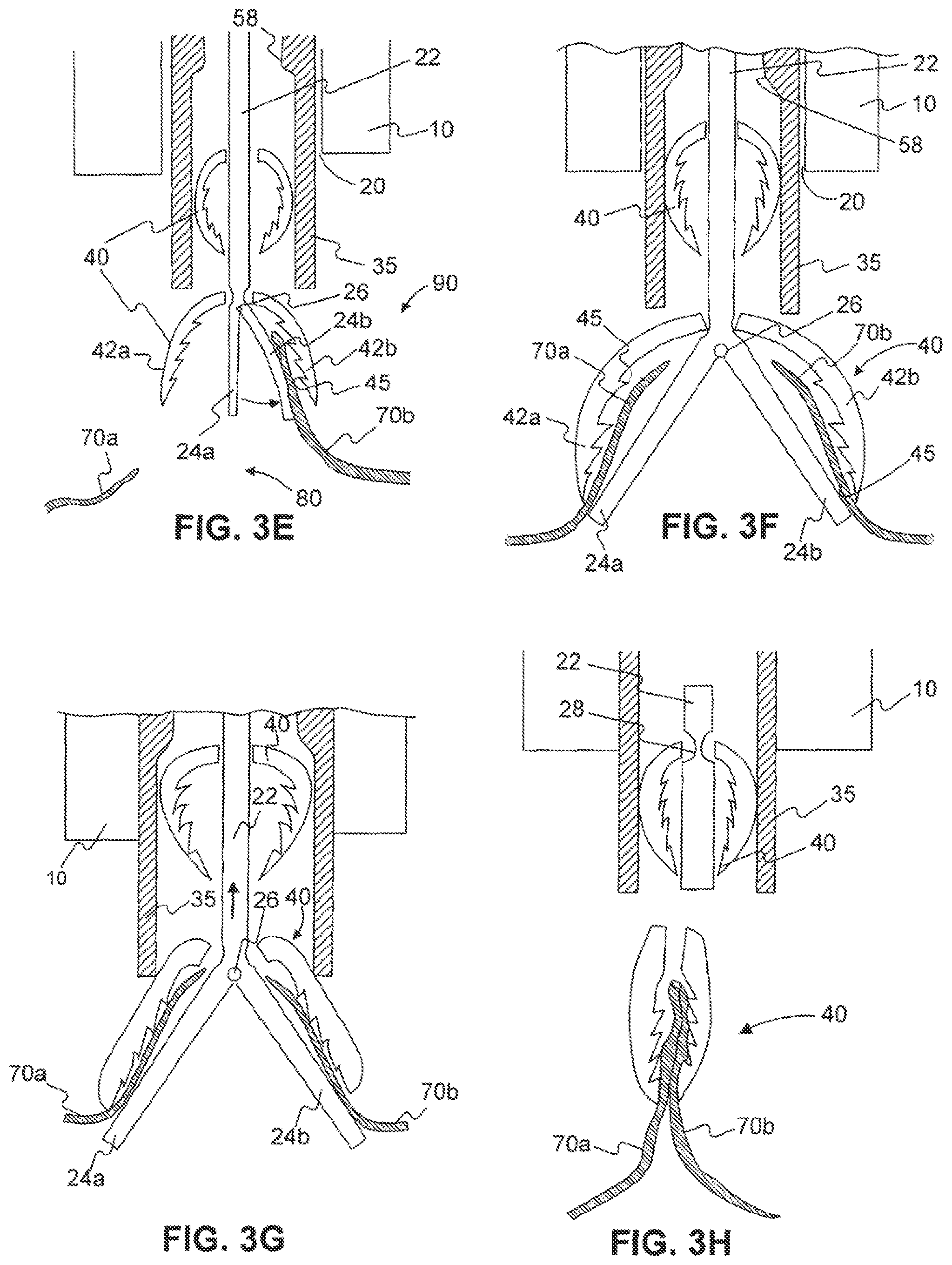 Patent US11779338 Figure 4 – Devices for approximating tissue and related