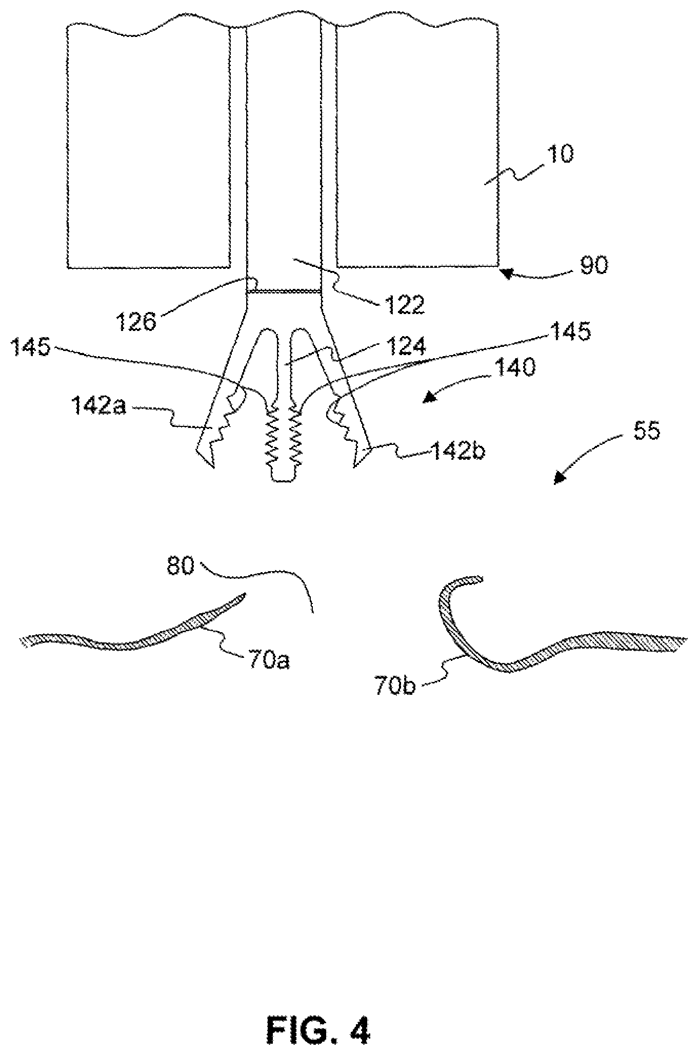 Patent US11779338 Figure 5 – Devices for approximating tissue and related