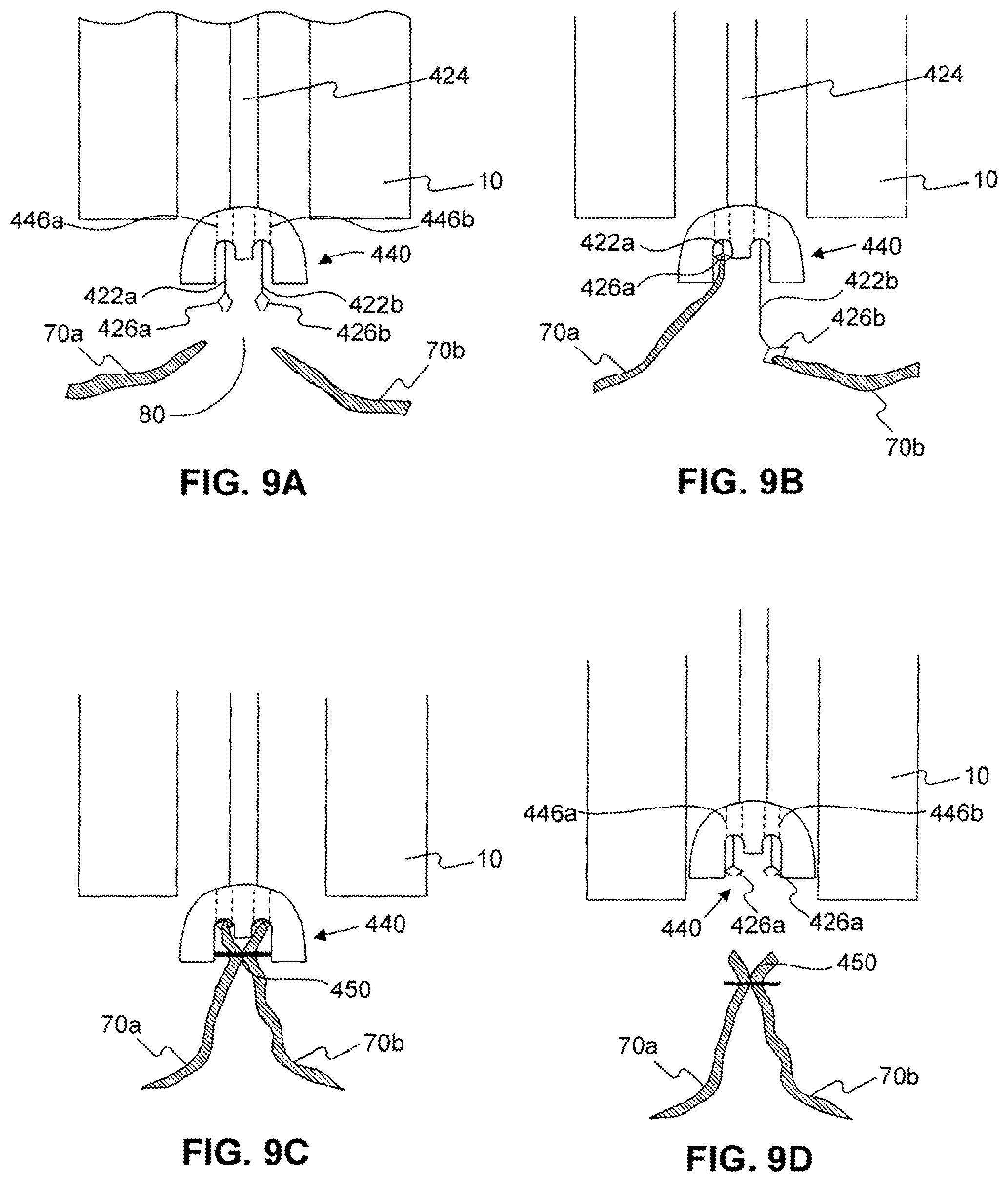 Patent US11779338 Figure 10 – Devices for approximating tissue and related