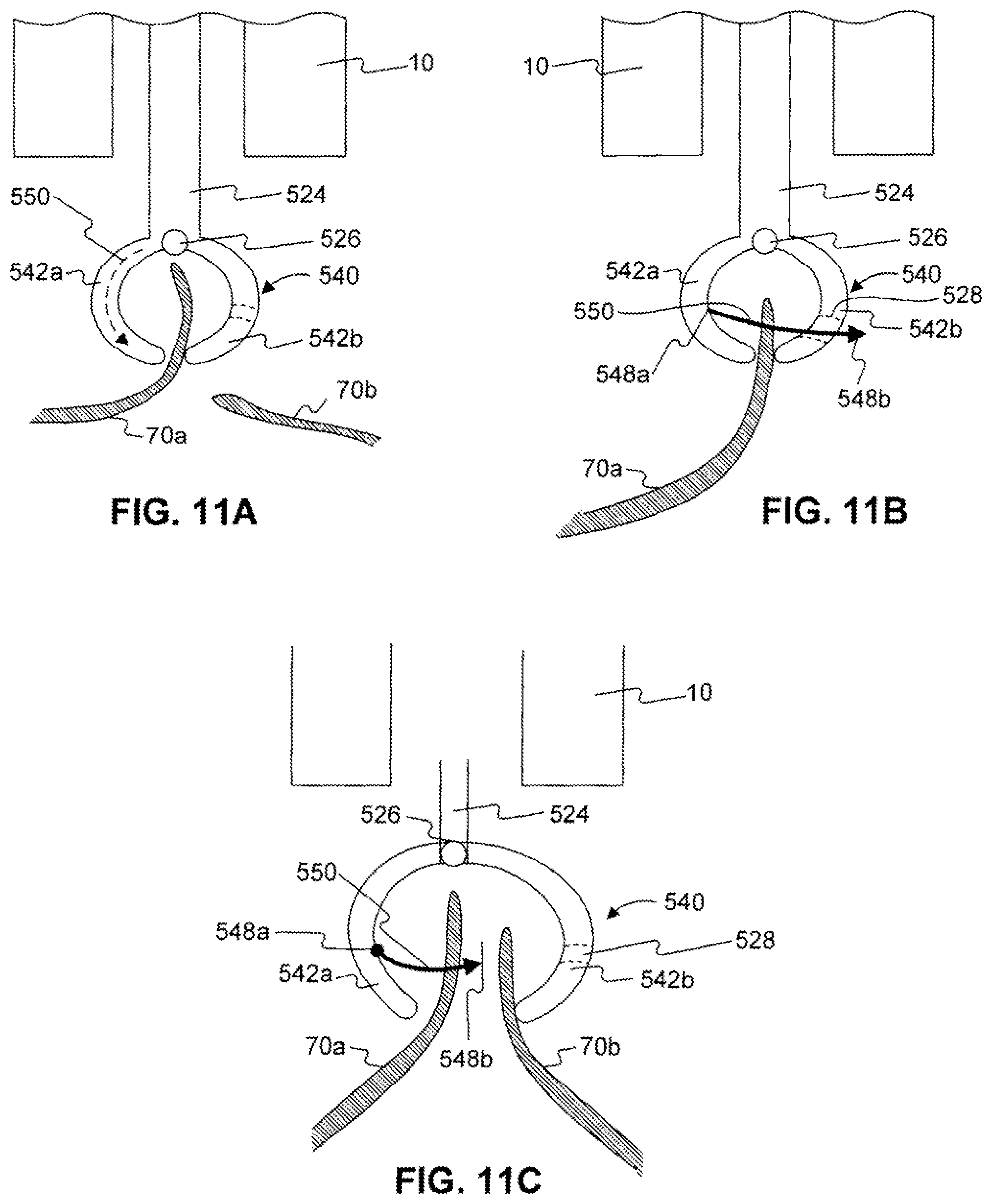 Patent US11779338 Figure 12 – Devices for approximating tissue and related