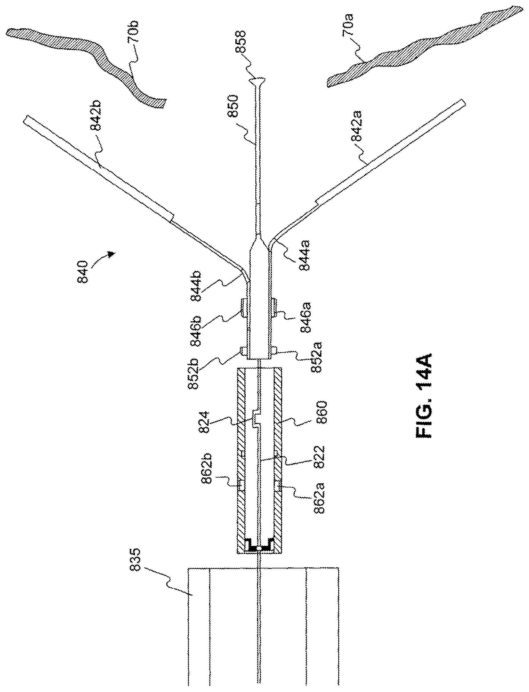 Patent US11779338 Figure 18 – Devices for approximating tissue and related