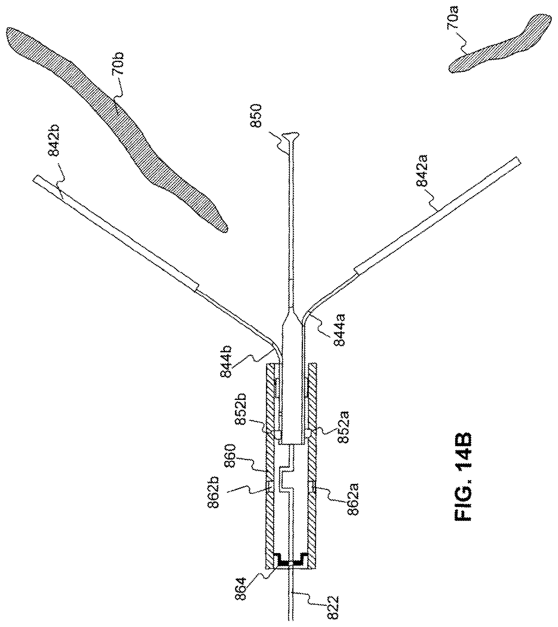 Patent US11779338 Figure 19 – Devices for approximating tissue and related