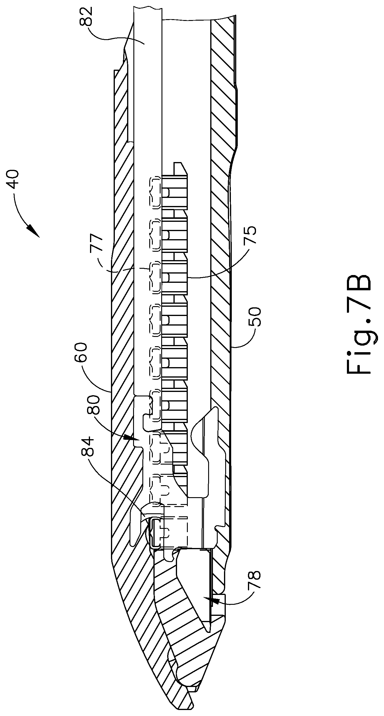 Patent US11779341 Figure 8 – Method of applying a buttress to a surgical stapler