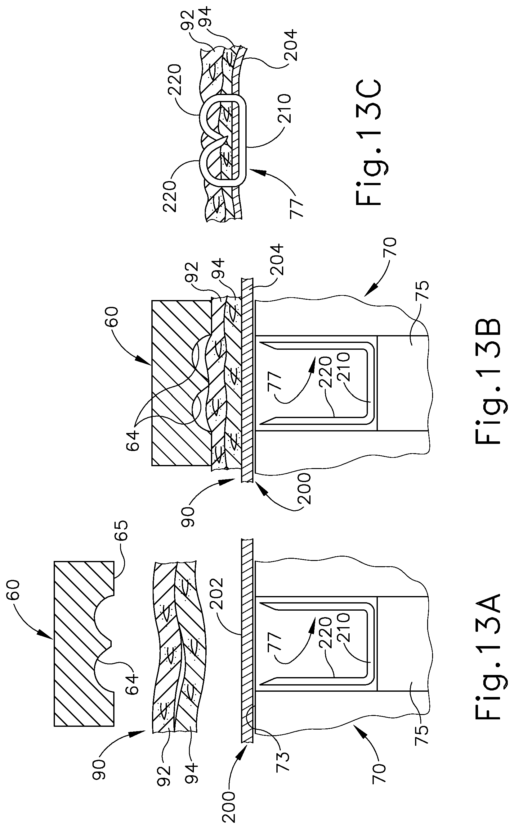Patent US11779341 Figure 15 – Method of applying a buttress to a surgical stapler