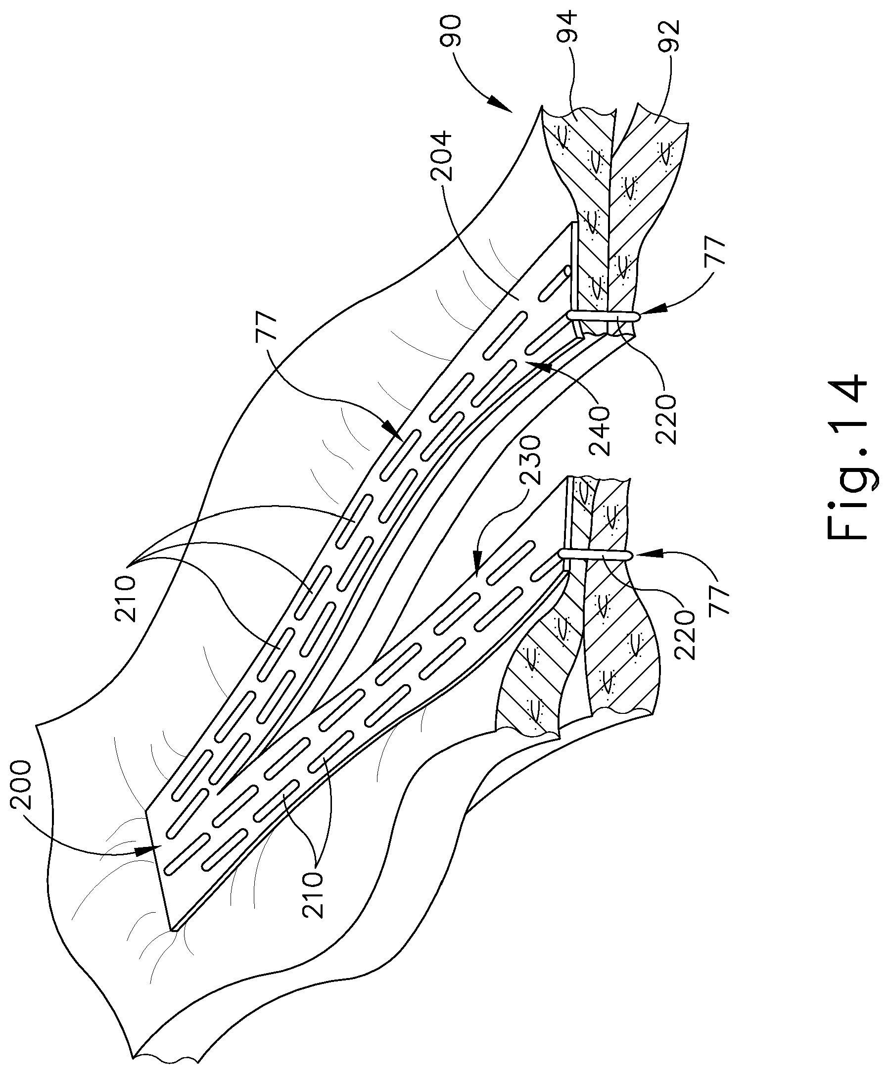 Patent US11779341 Figure 16 – Method of applying a buttress to a surgical stapler