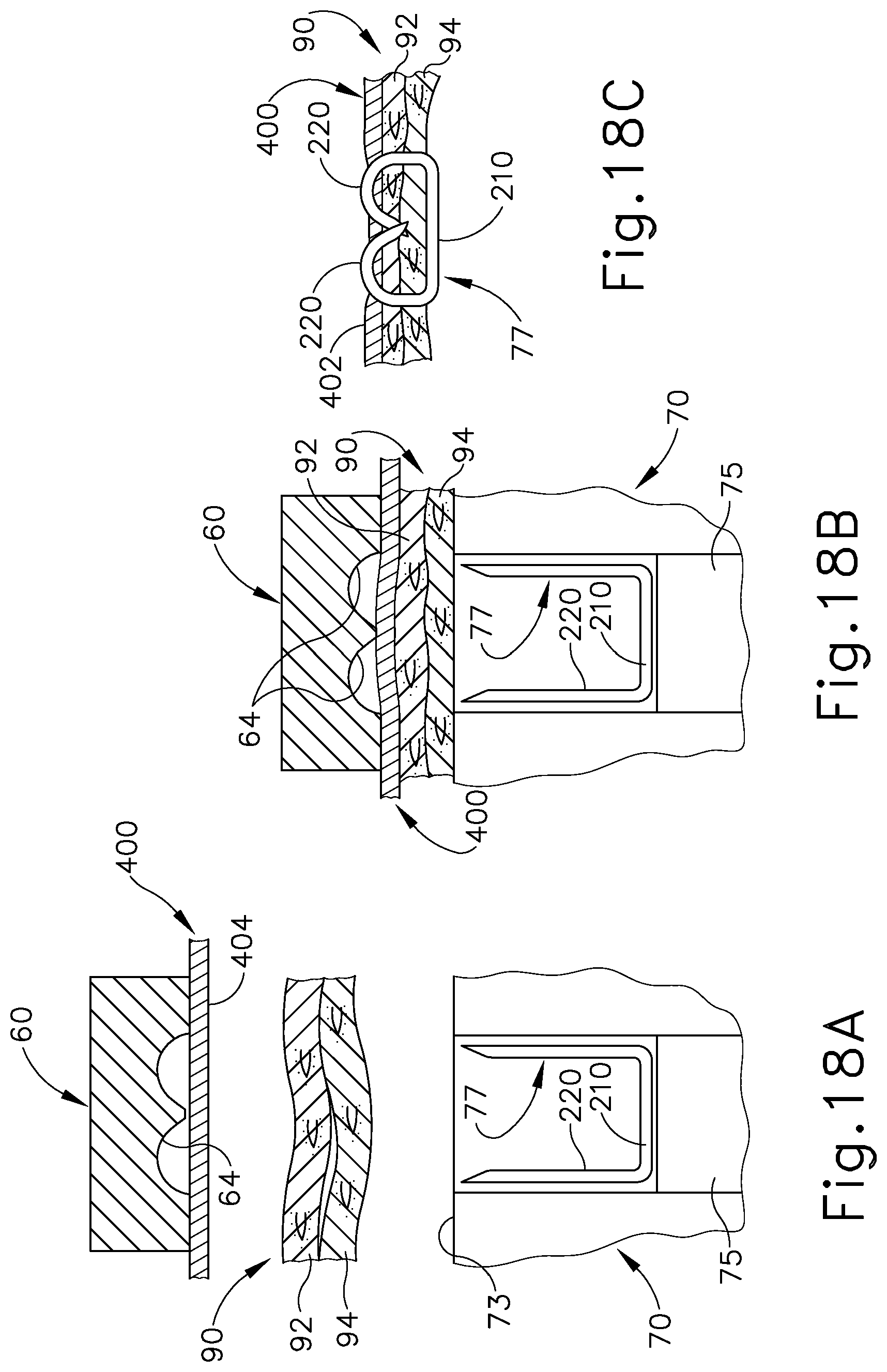 Patent US11779341 Figure 20 – Method of applying a buttress to a surgical stapler