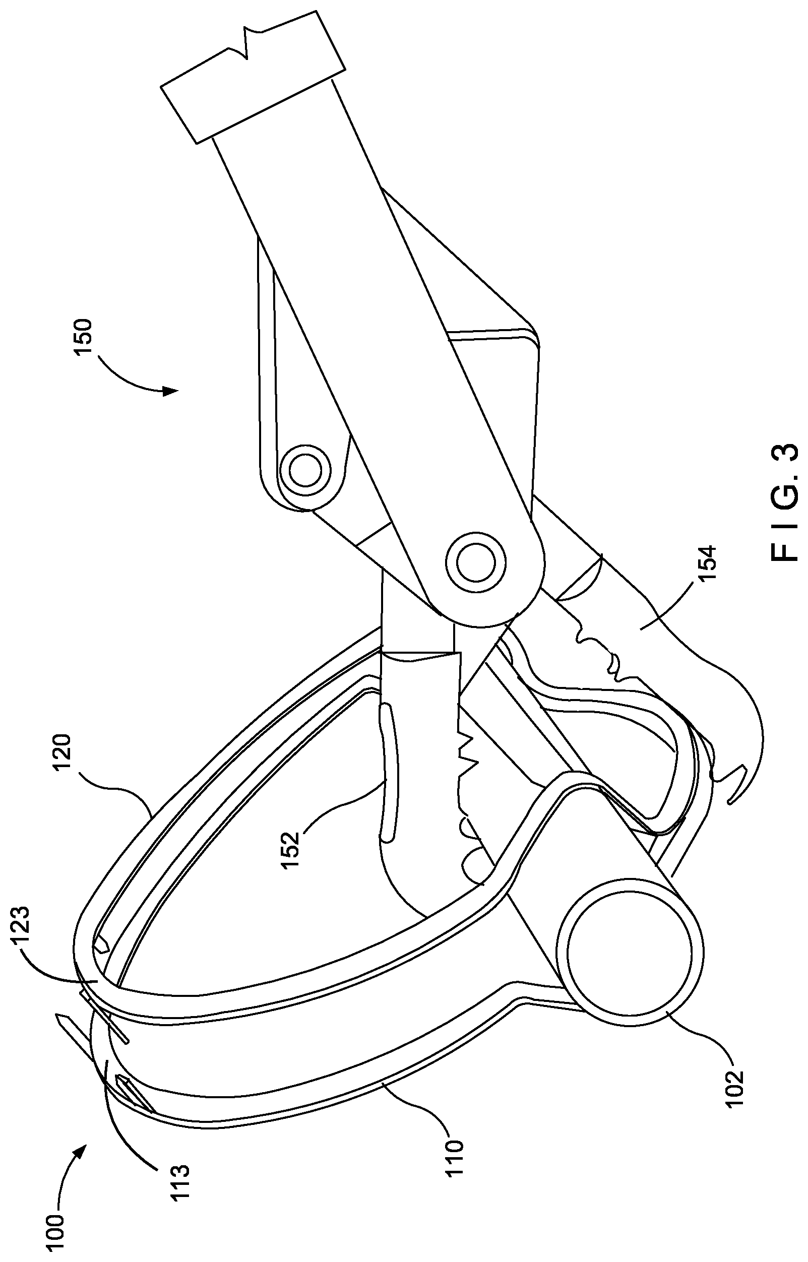 Patent US11779344 Figure 3 – Repositionable closure device