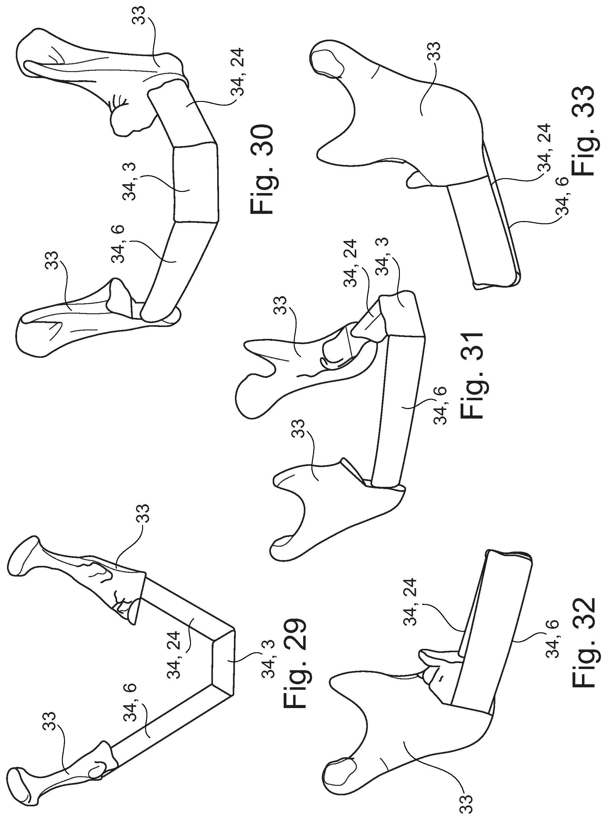 Patent US11779346 Figure 13 – Fibula bone material removal and transfer template