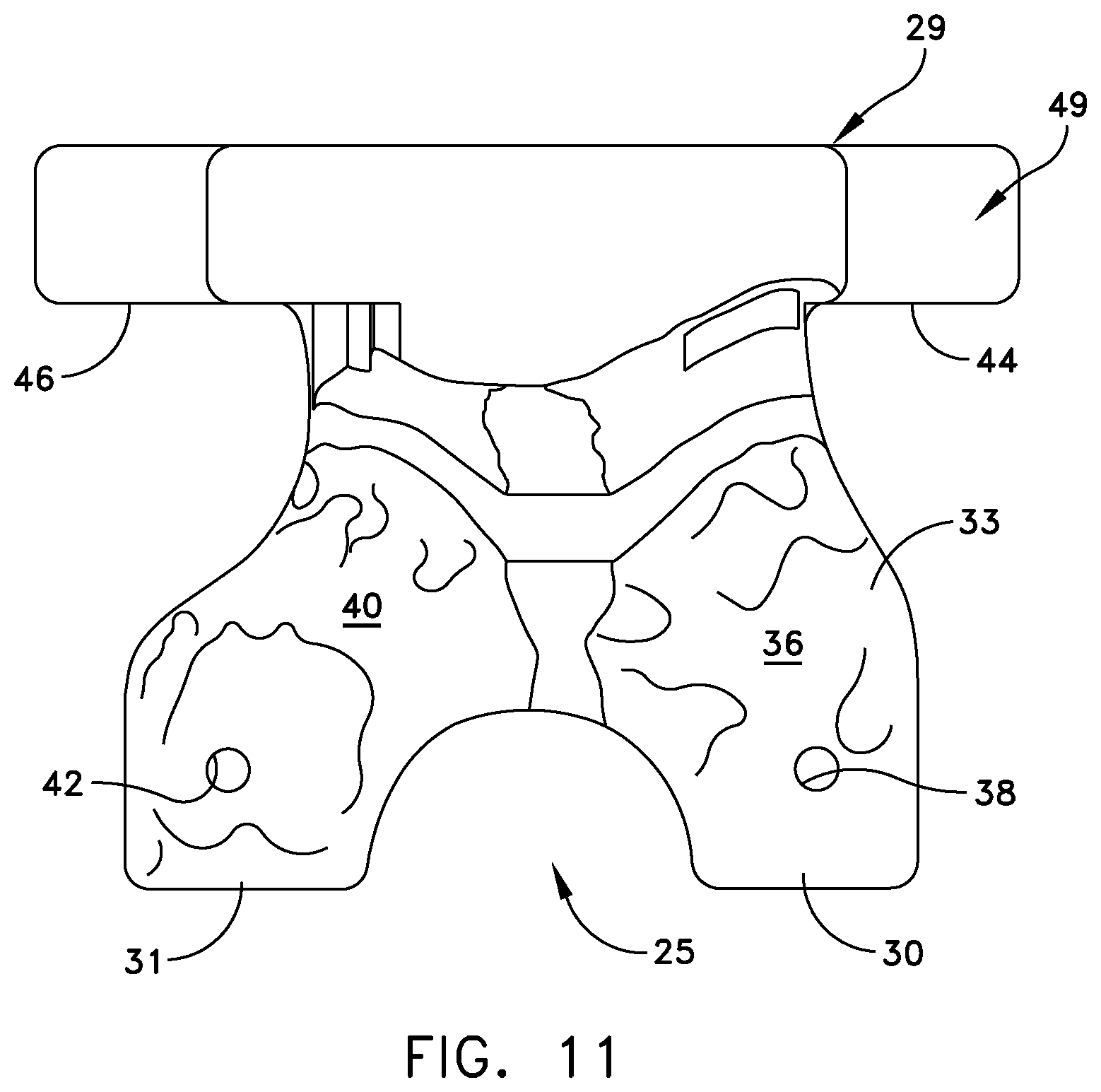 Patent US11779347 Figure 8 – System for forming a patient specific surgical guide mount