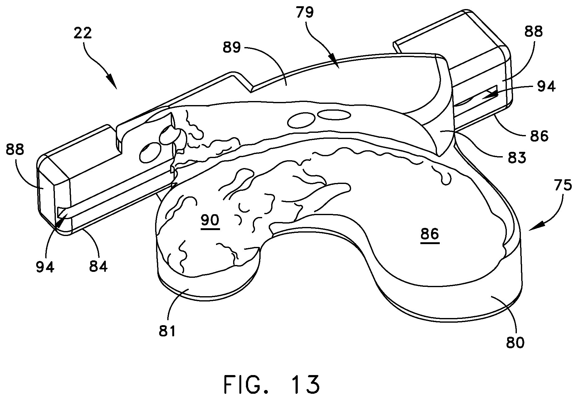 Patent US11779347 Figure 10 – System for forming a patient specific surgical guide mount