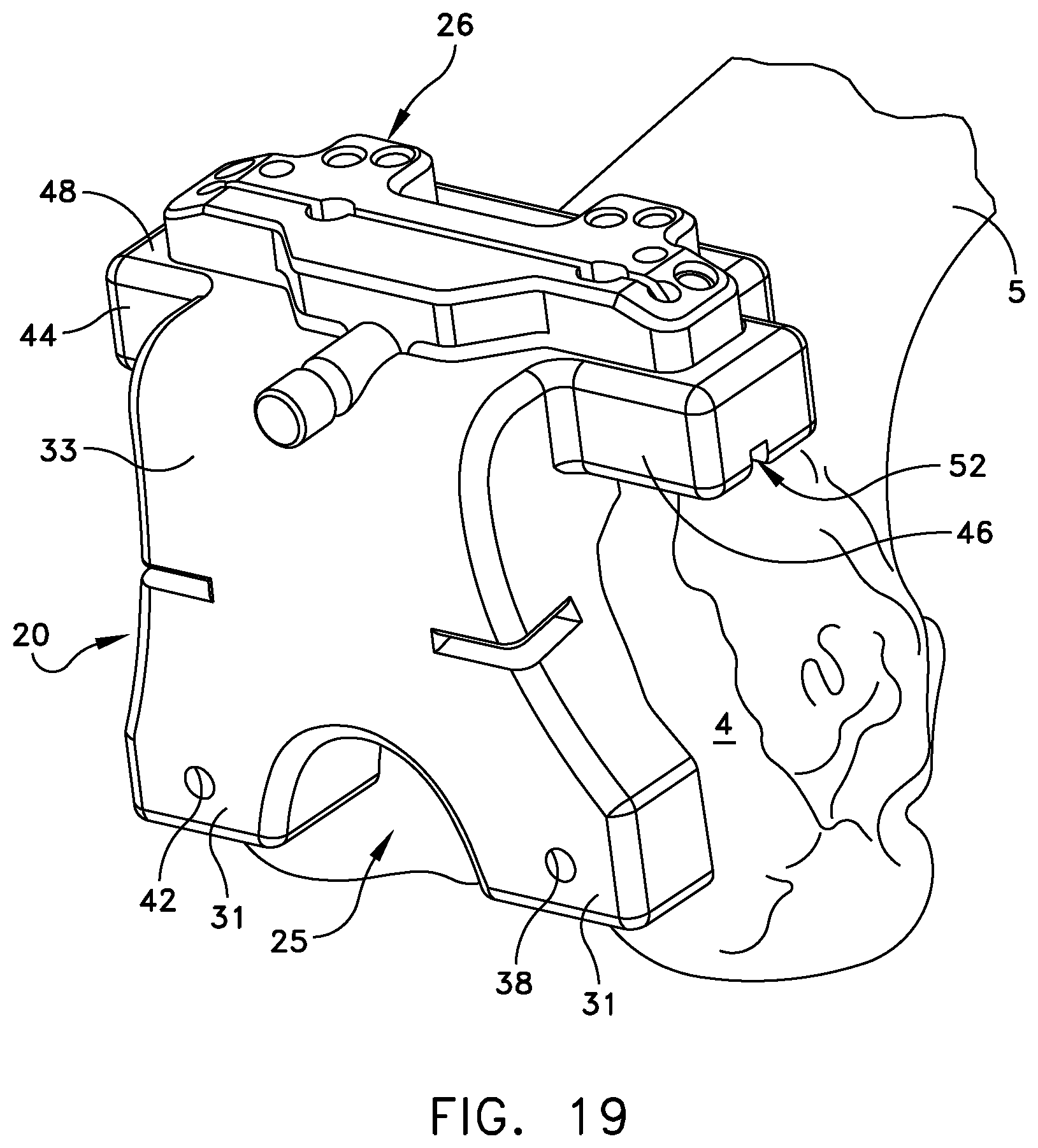 Patent US11779347 Figure 15 – System for forming a patient specific surgical guide mount