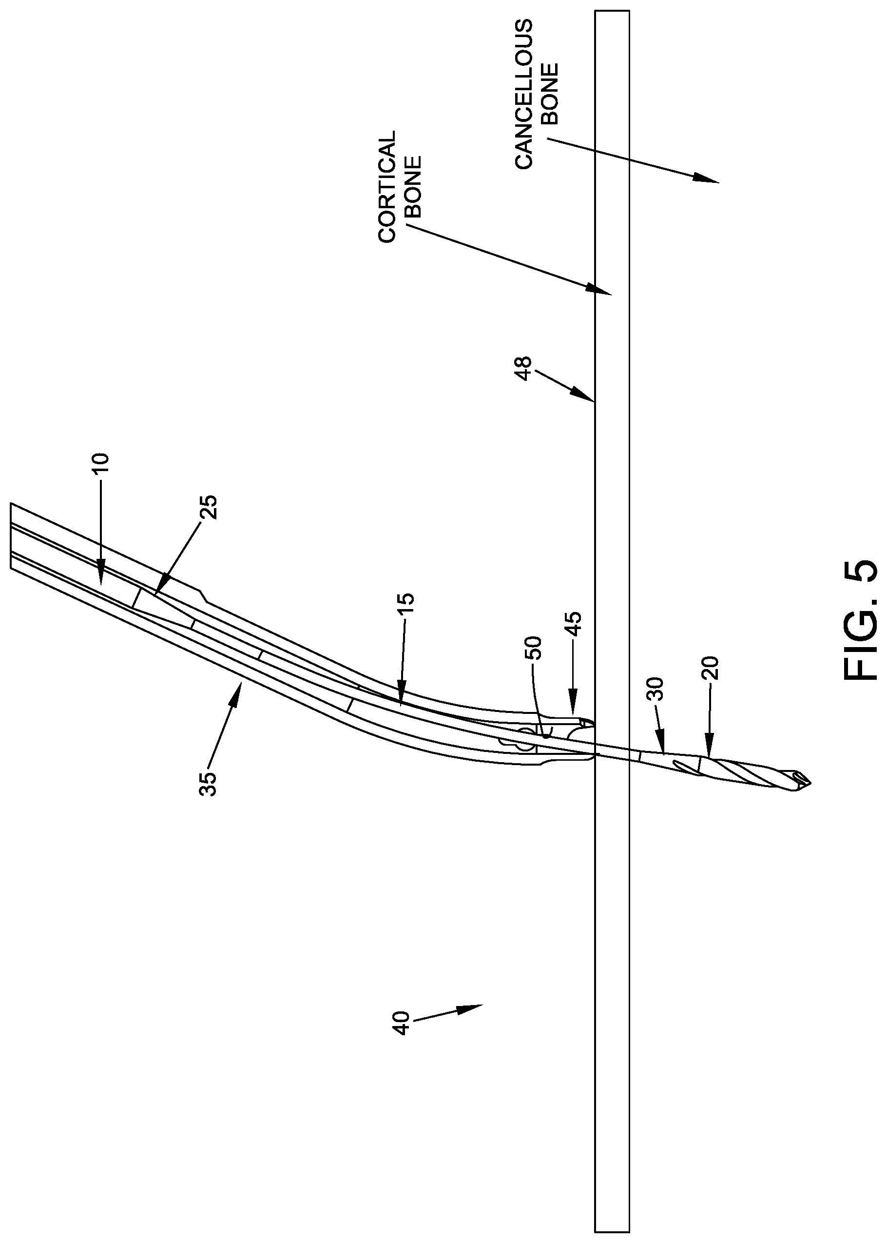 Patent US11779349 Figure 5 – Flexible drill bit and angled drill guide for use with the same
