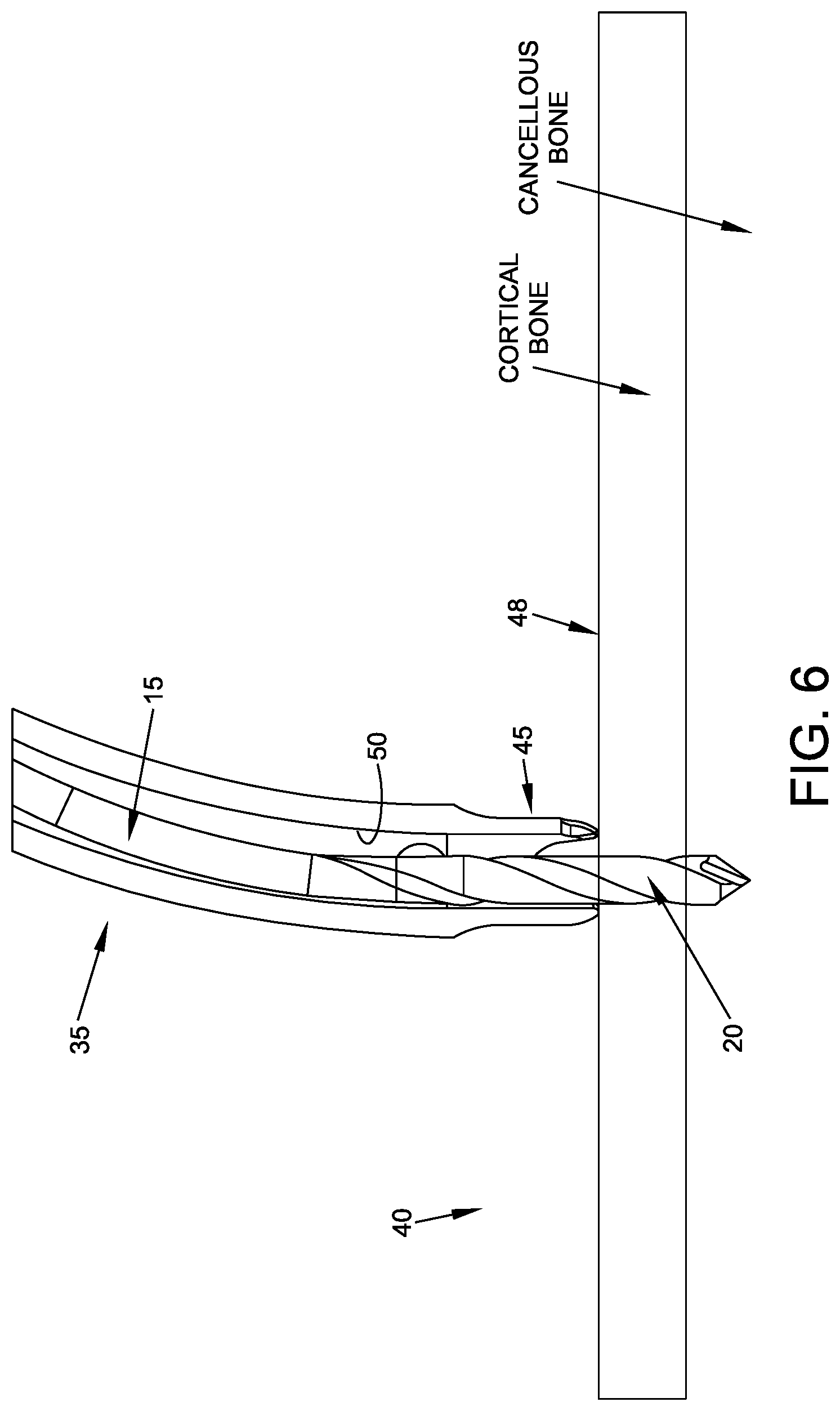 Patent US11779349 Figure 6 – Flexible drill bit and angled drill guide for use with the same