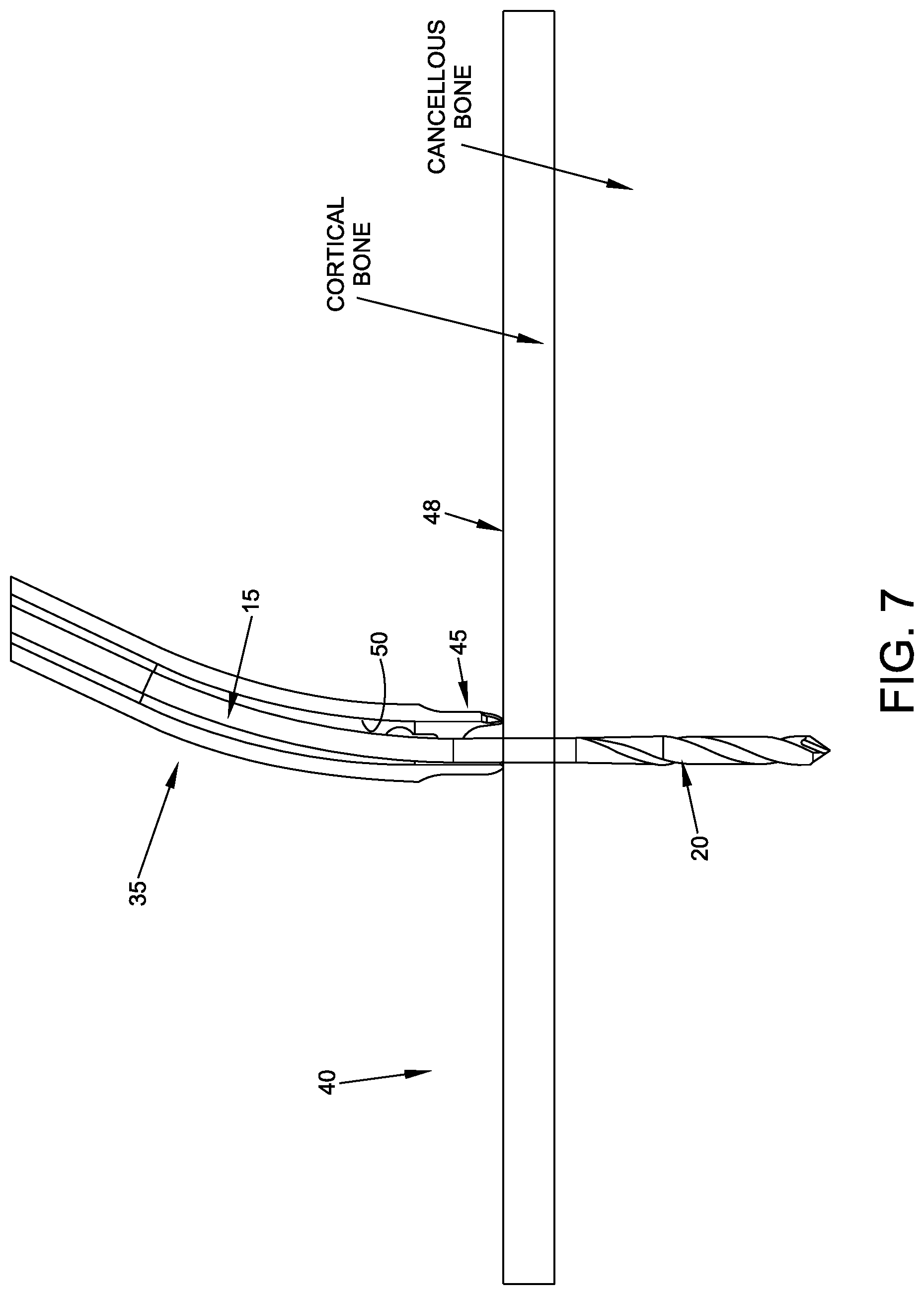 Patent US11779349 Figure 7 – Flexible drill bit and angled drill guide for use with the same