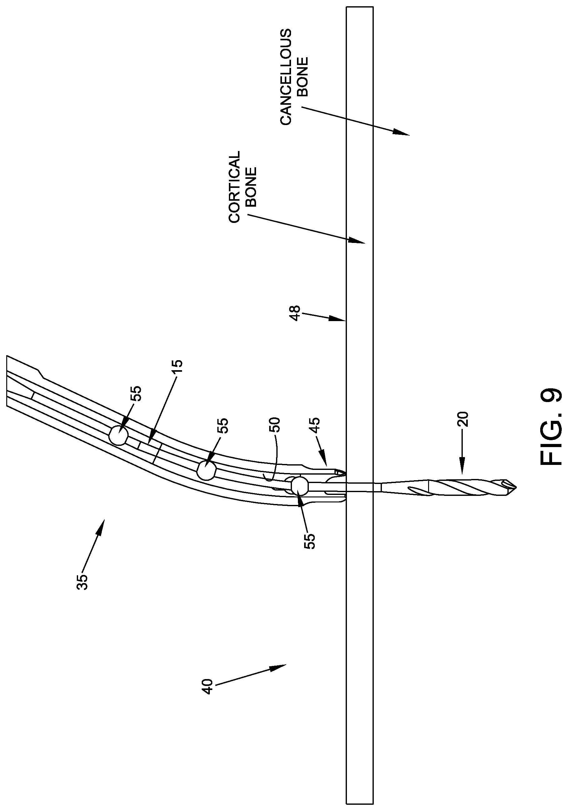 Patent US11779349 Figure 9 – Flexible drill bit and angled drill guide for use with the same