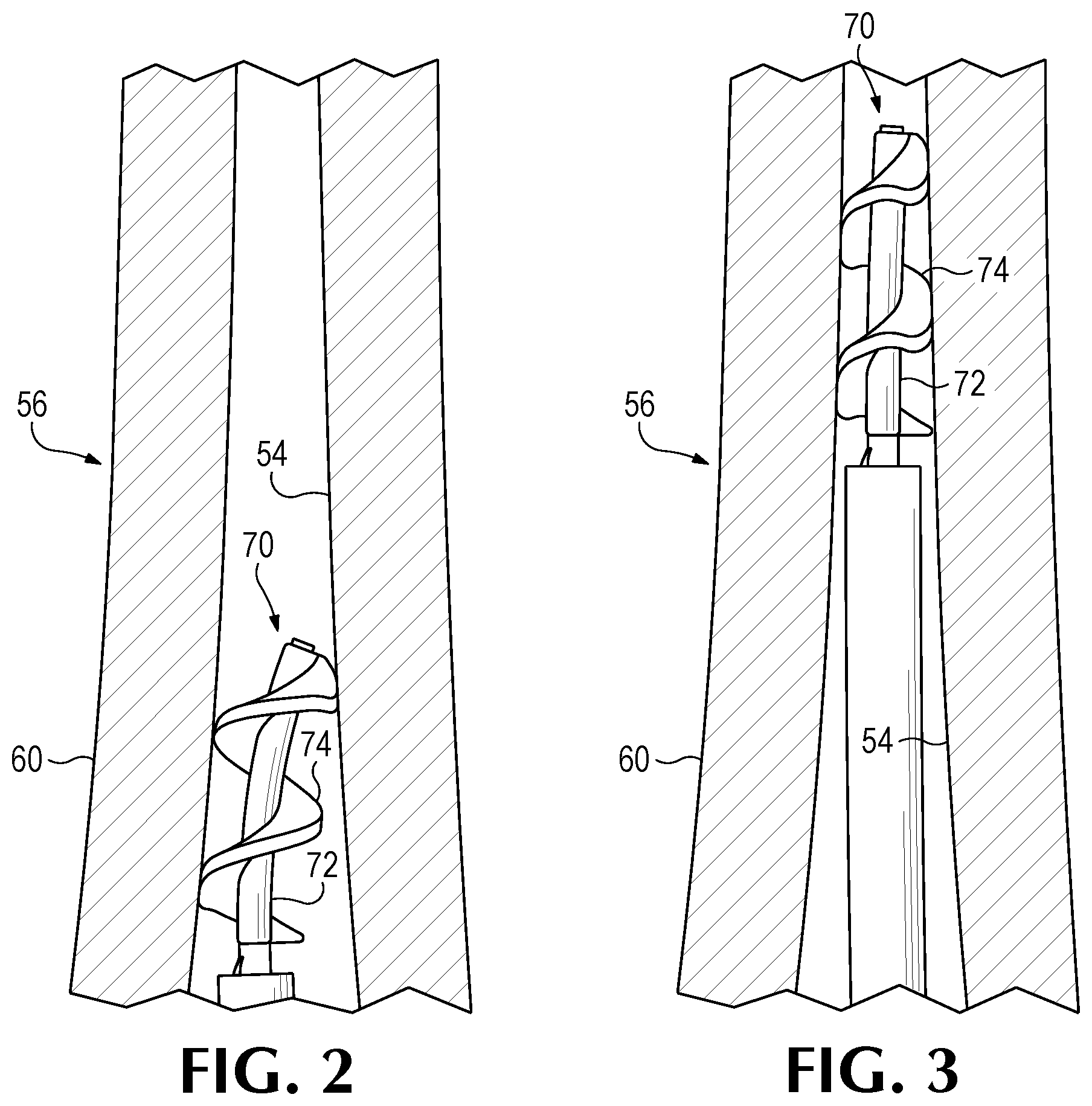 Patent US11779350 Figure 2 – Bone harvesting system