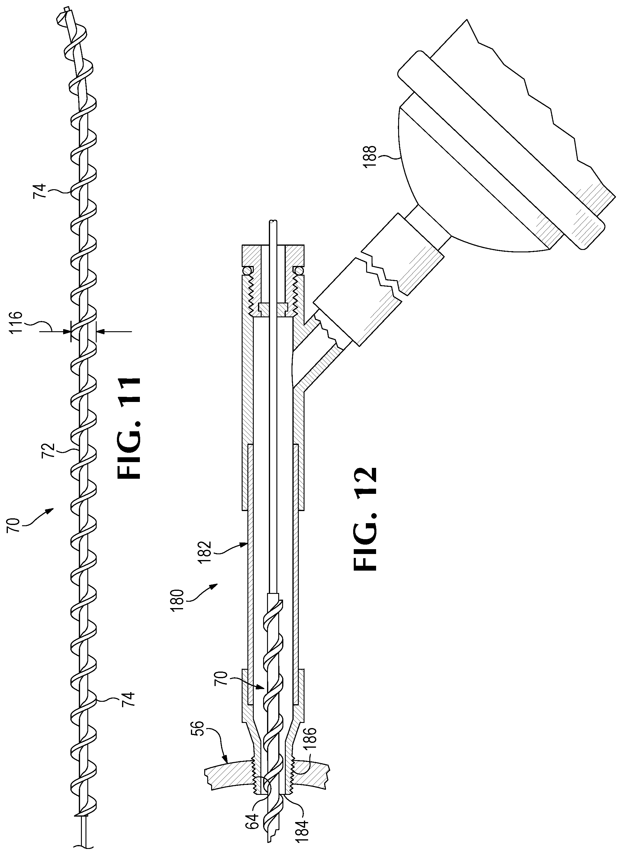 Patent US11779350 Figure 6 – Bone harvesting system