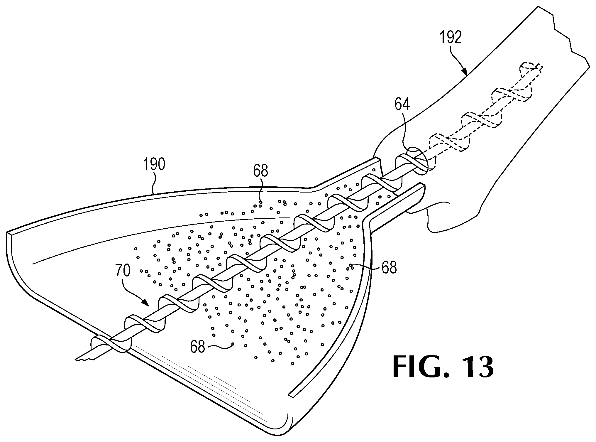 Patent US11779350 Figure 7 – Bone harvesting system
