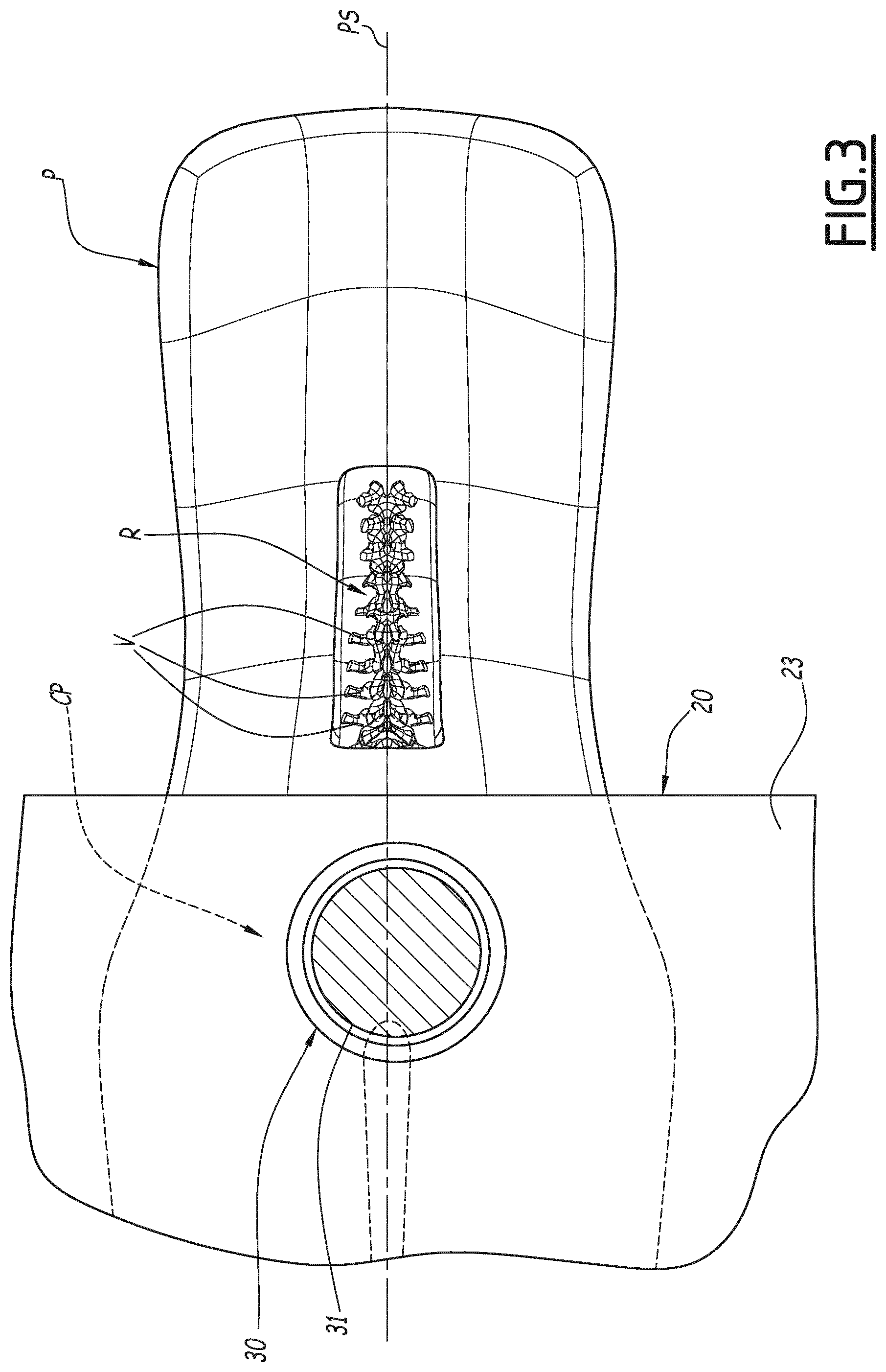Patent US11779351 Figure 3 – Installation for robotic spine surgery