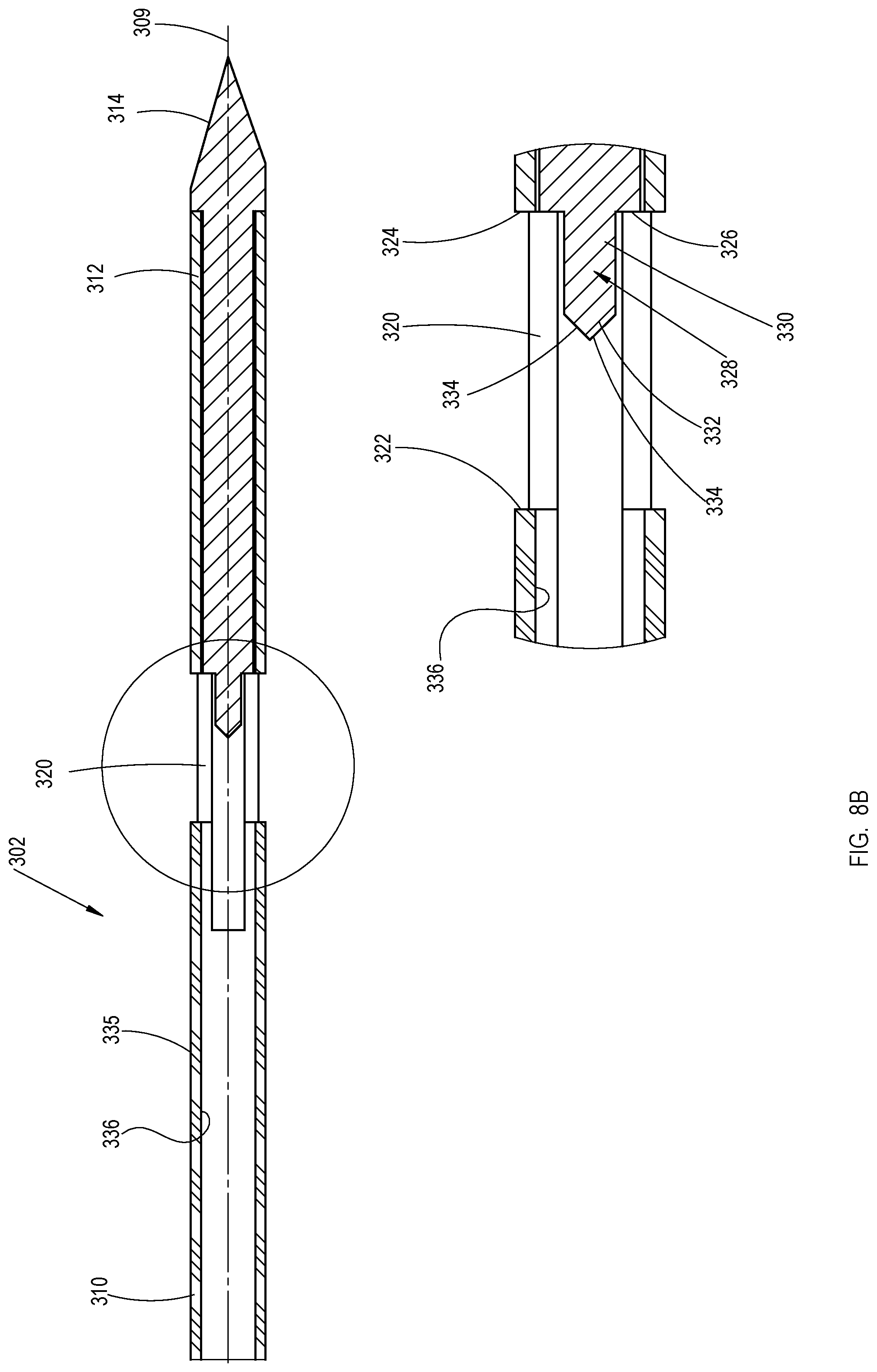 Patent US11779353 Figure 12 – Bone material removal device and a method for use thereof