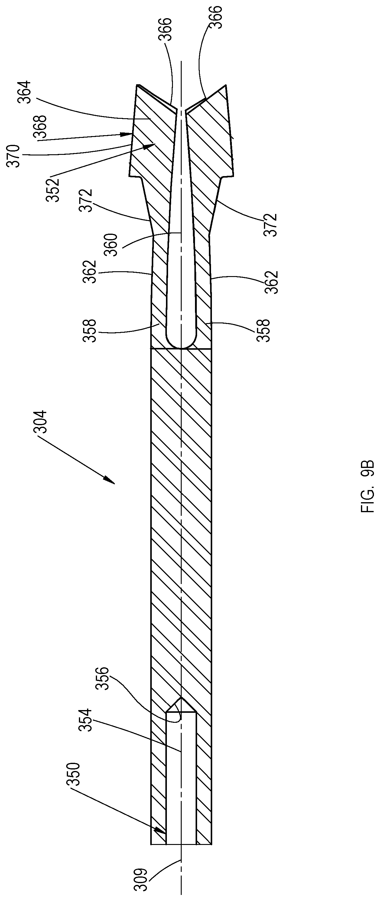 Patent US11779353 Figure 14 – Bone material removal device and a method for use thereof