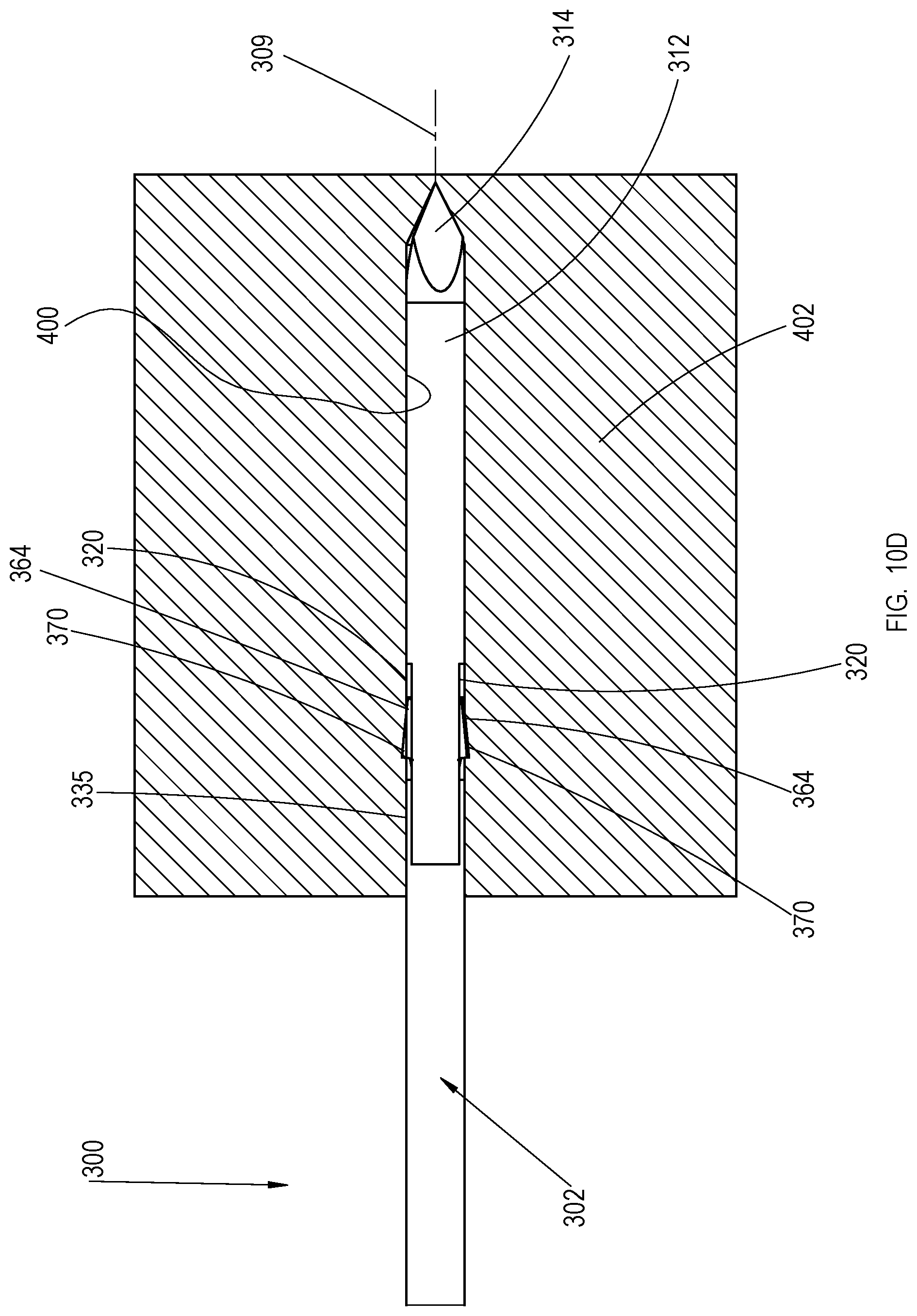 Patent US11779353 Figure 18 – Bone material removal device and a method for use thereof