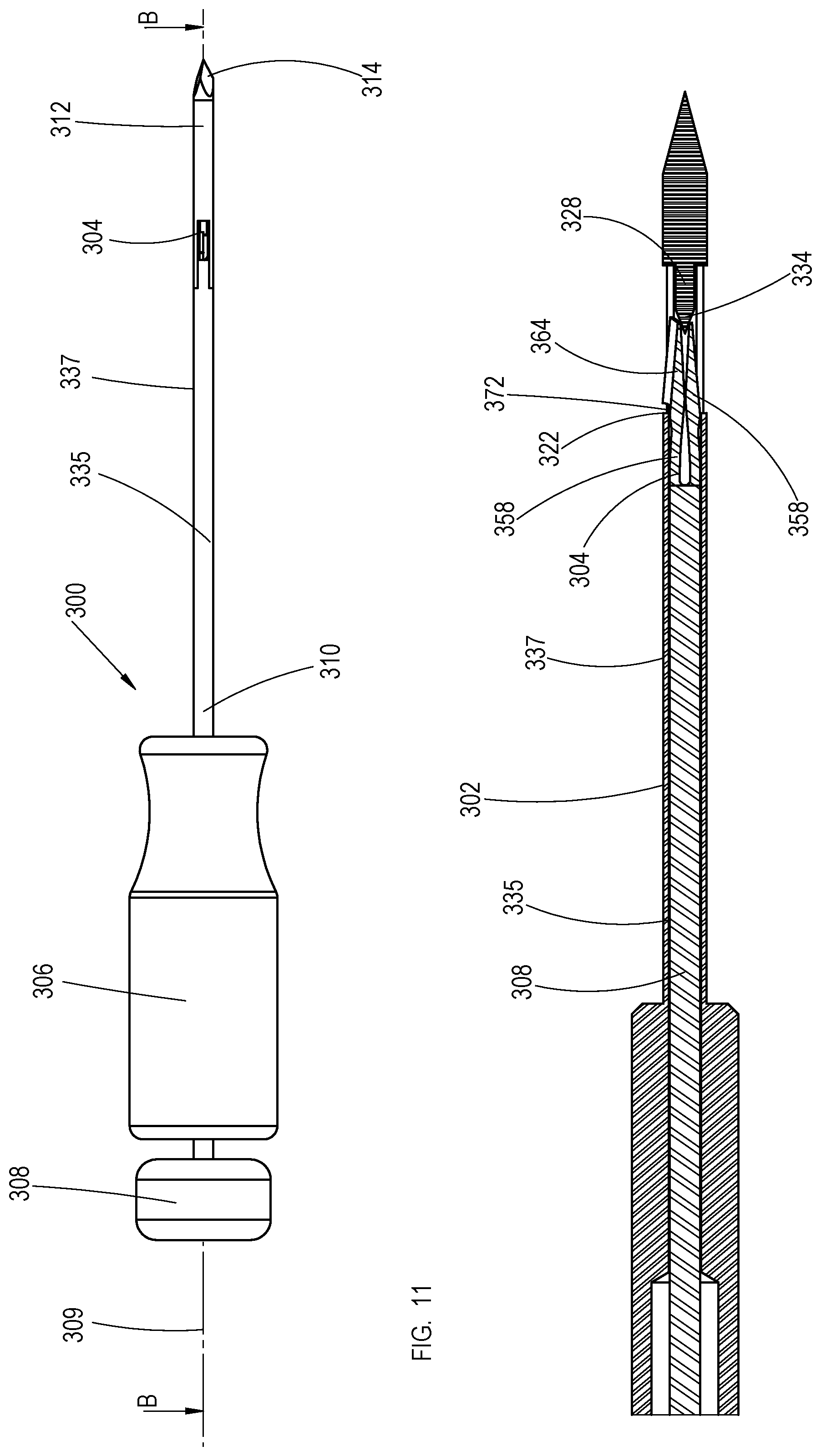 Patent US11779353 Figure 19 – Bone material removal device and a method for use thereof