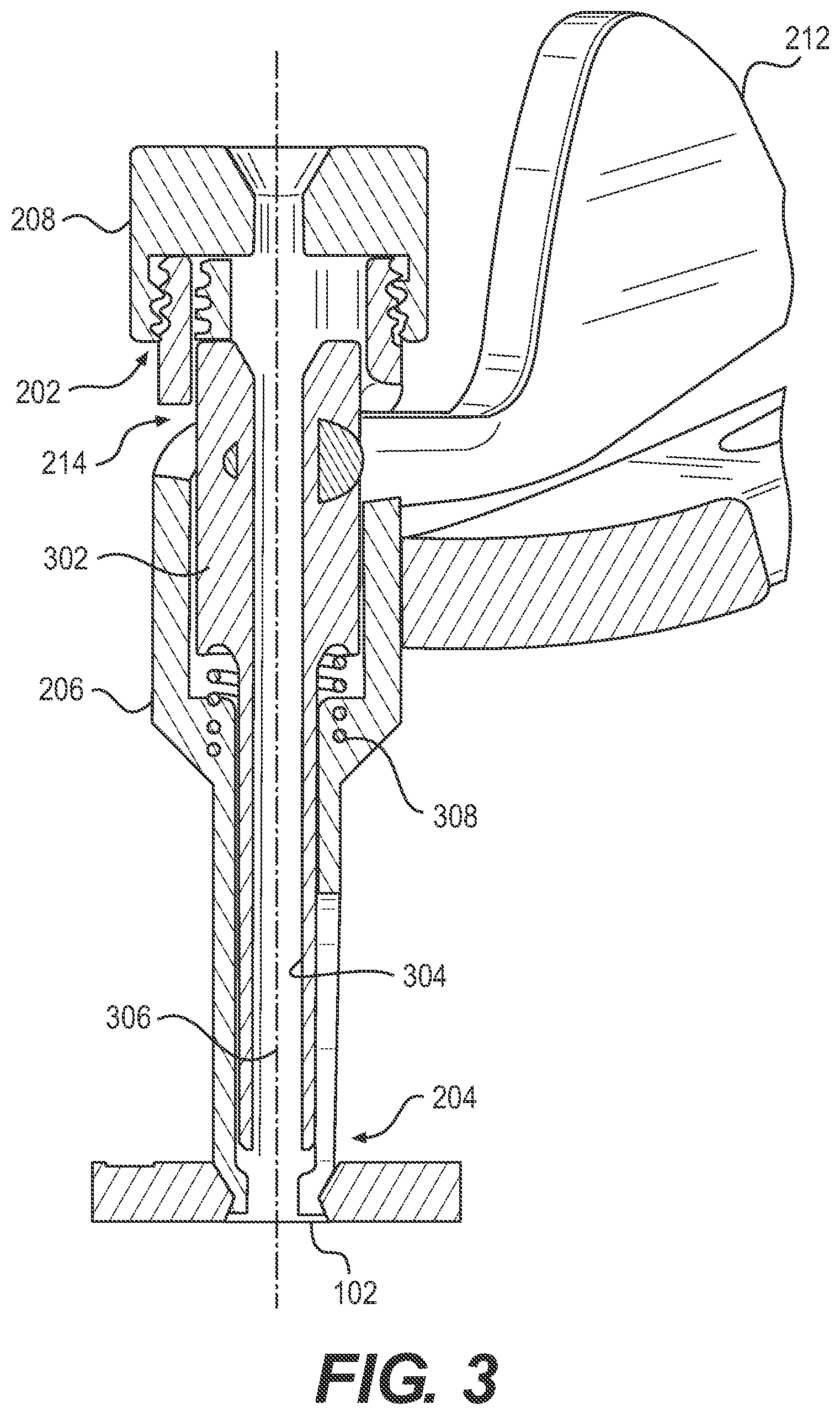 Patent US11779354 Figure 3 – Method and apparatus for locking a drill guide in a polyaxial hole