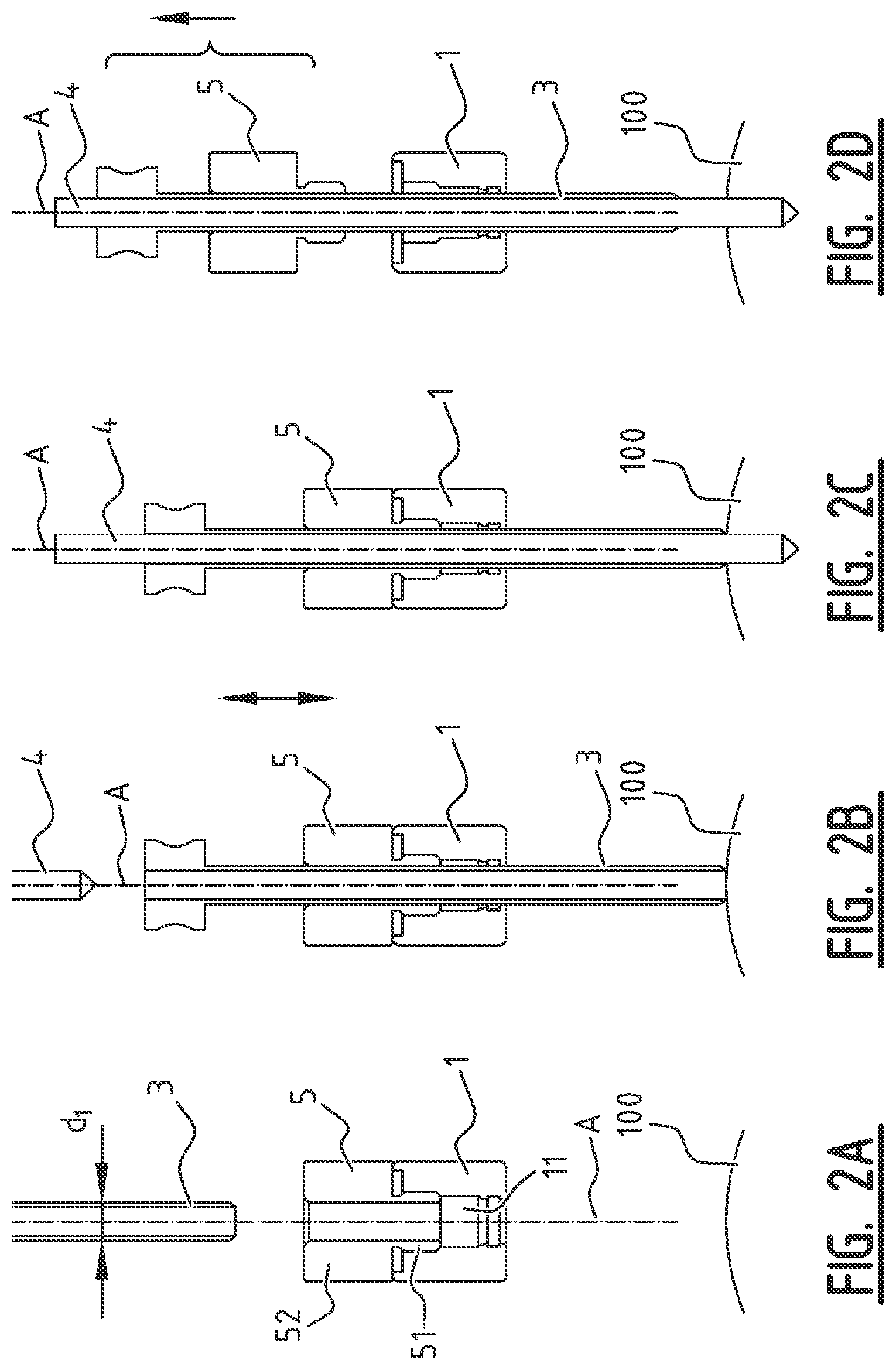 Patent US11779355 Figure 2 – System for connecting a connecting device, in particular a distractor, to a bone