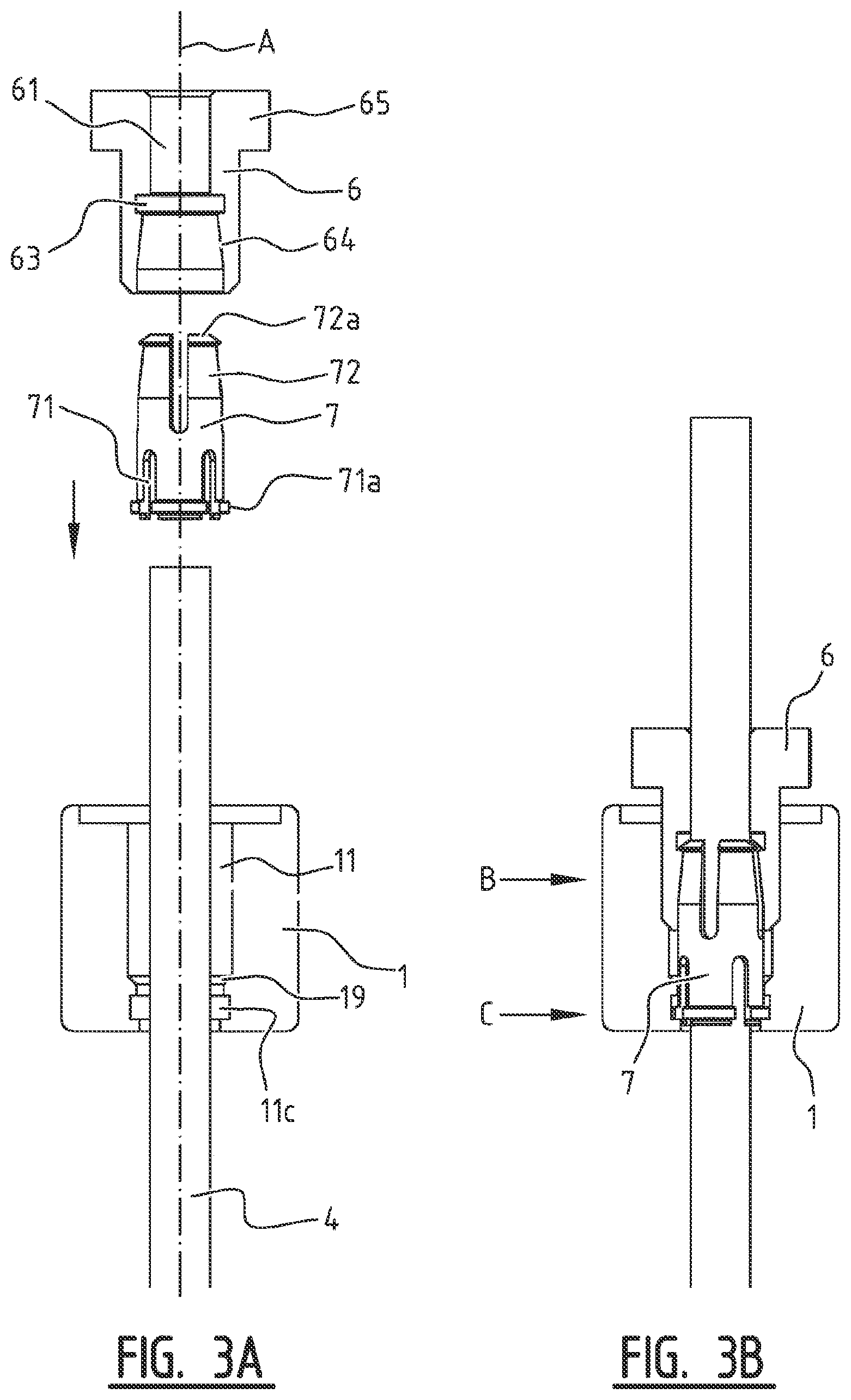 Patent US11779355 Figure 3 – System for connecting a connecting device, in particular a distractor, to a bone