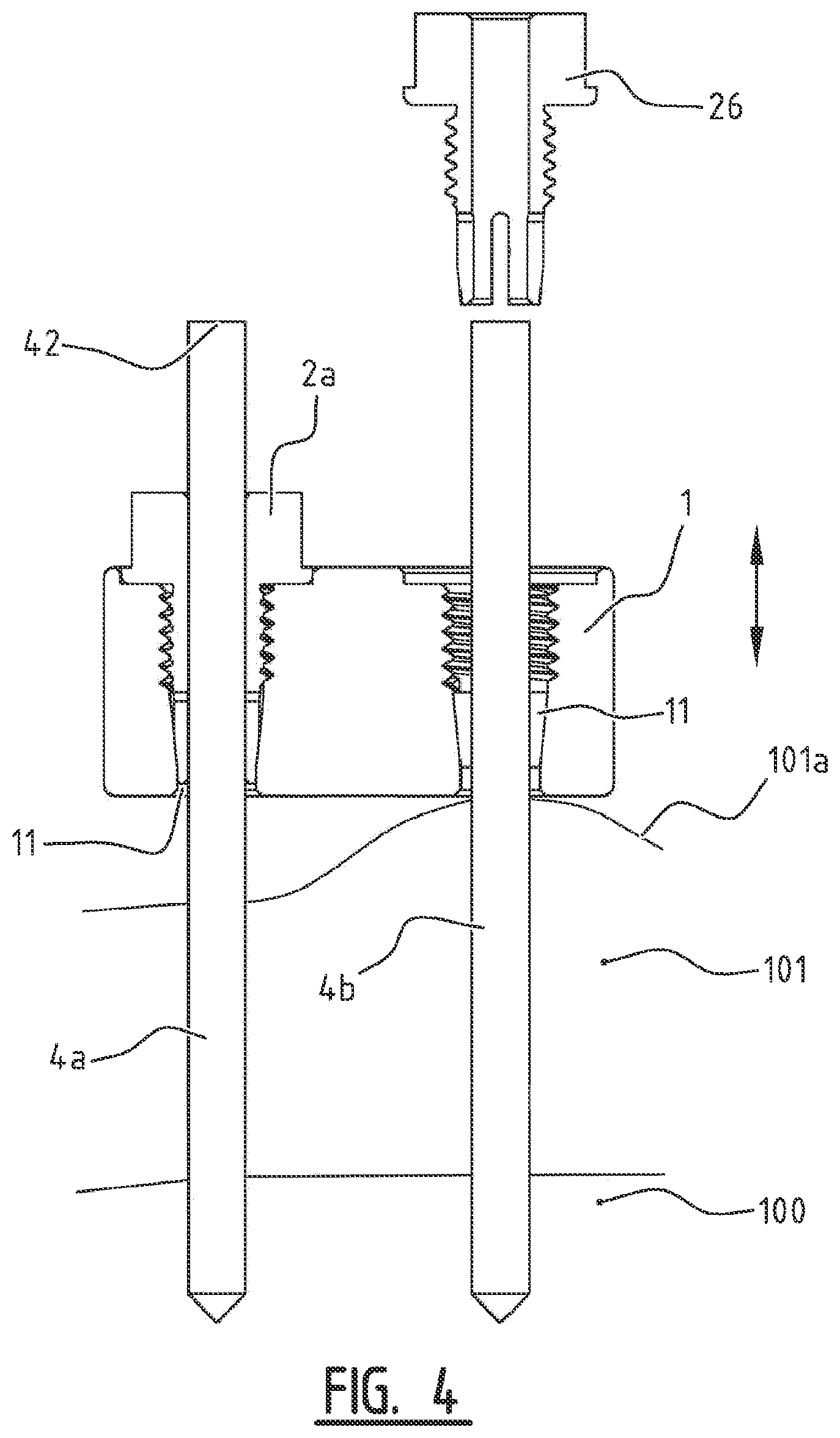 Patent US11779355 Figure 4 – System for connecting a connecting device, in particular a distractor, to a bone