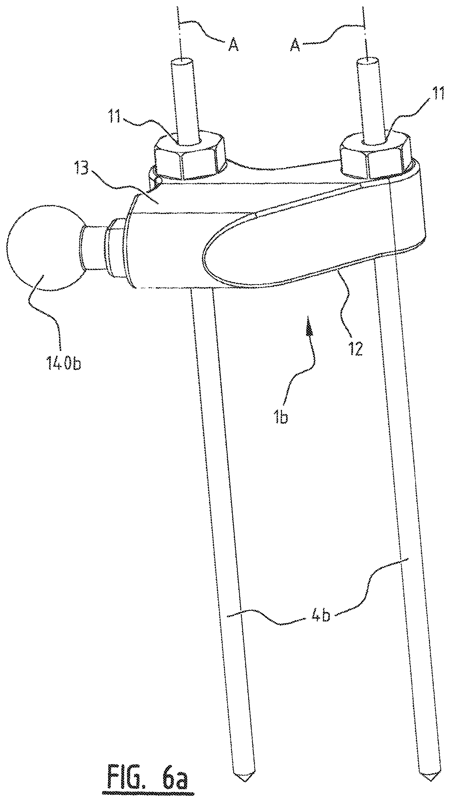 Patent US11779355 Figure 6 – System for connecting a connecting device, in particular a distractor, to a bone