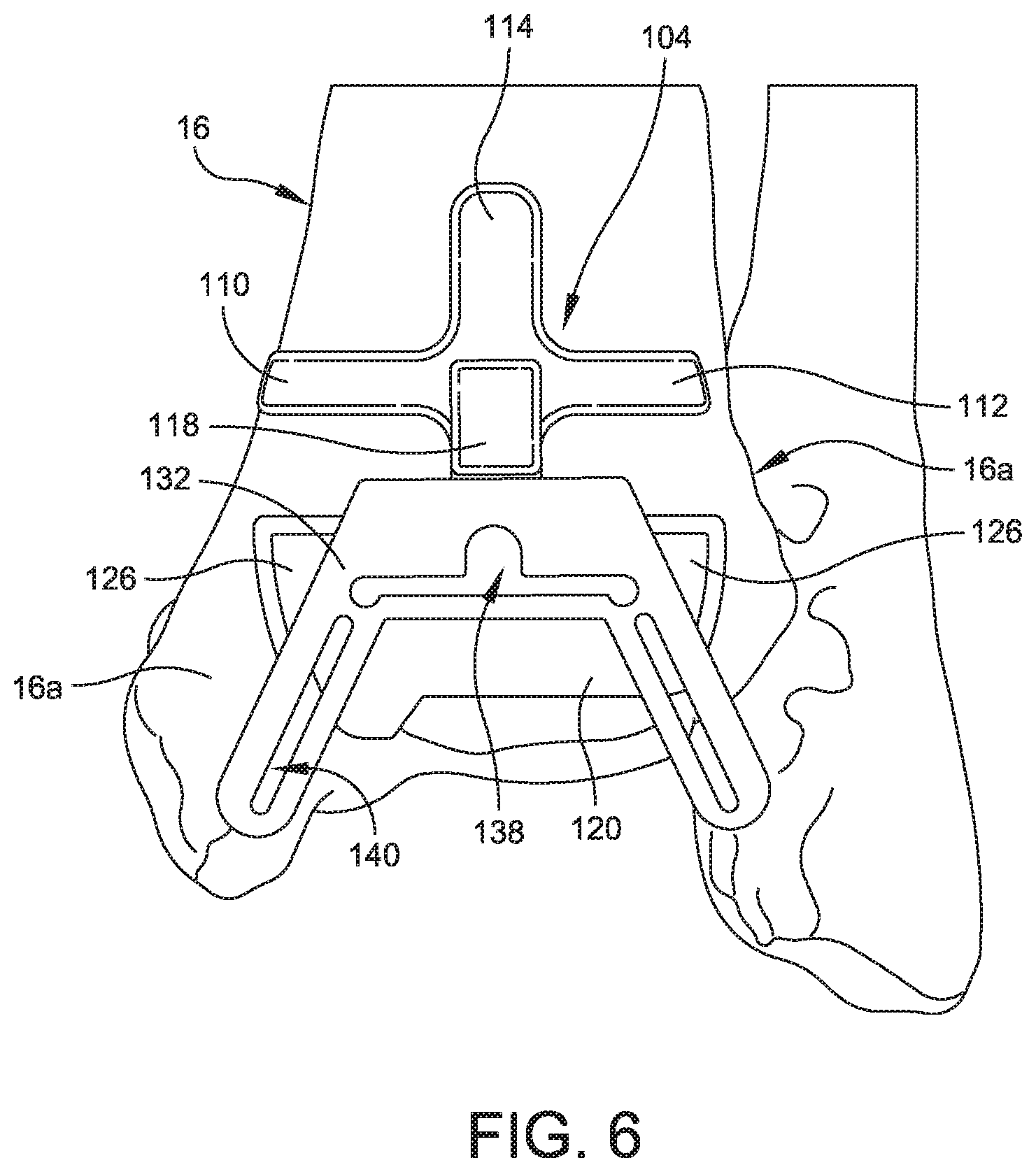 Patent US11779356 Figure 6 – Orthopedic surgical guide