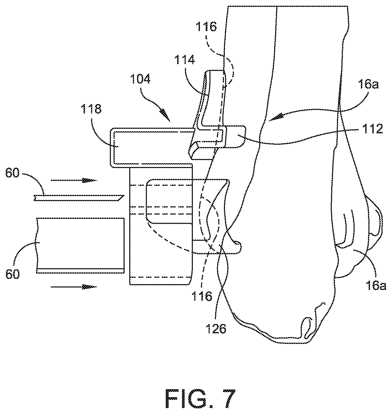 Patent US11779356 Figure 7 – Orthopedic surgical guide