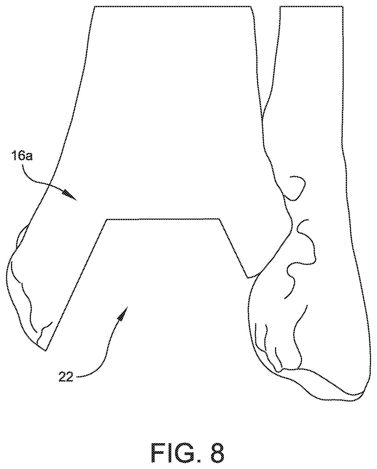 Patent US11779356 Figure 8 – Orthopedic surgical guide