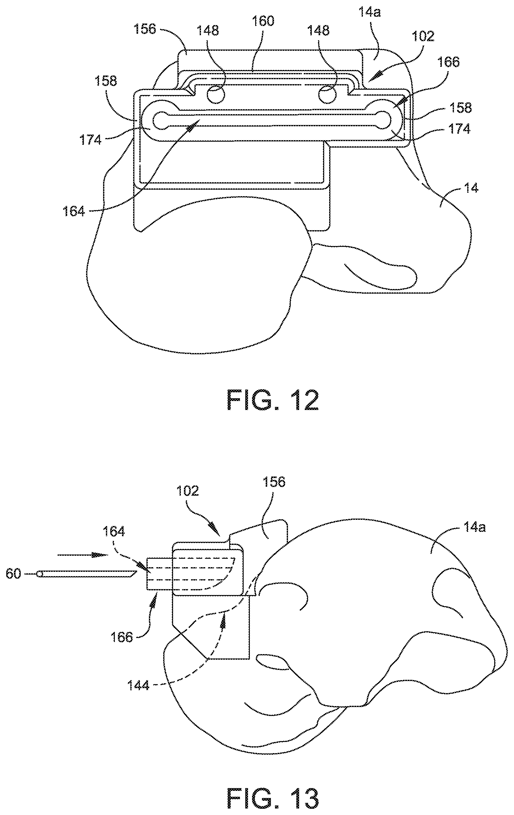 Patent US11779356 Figure 11 – Orthopedic surgical guide