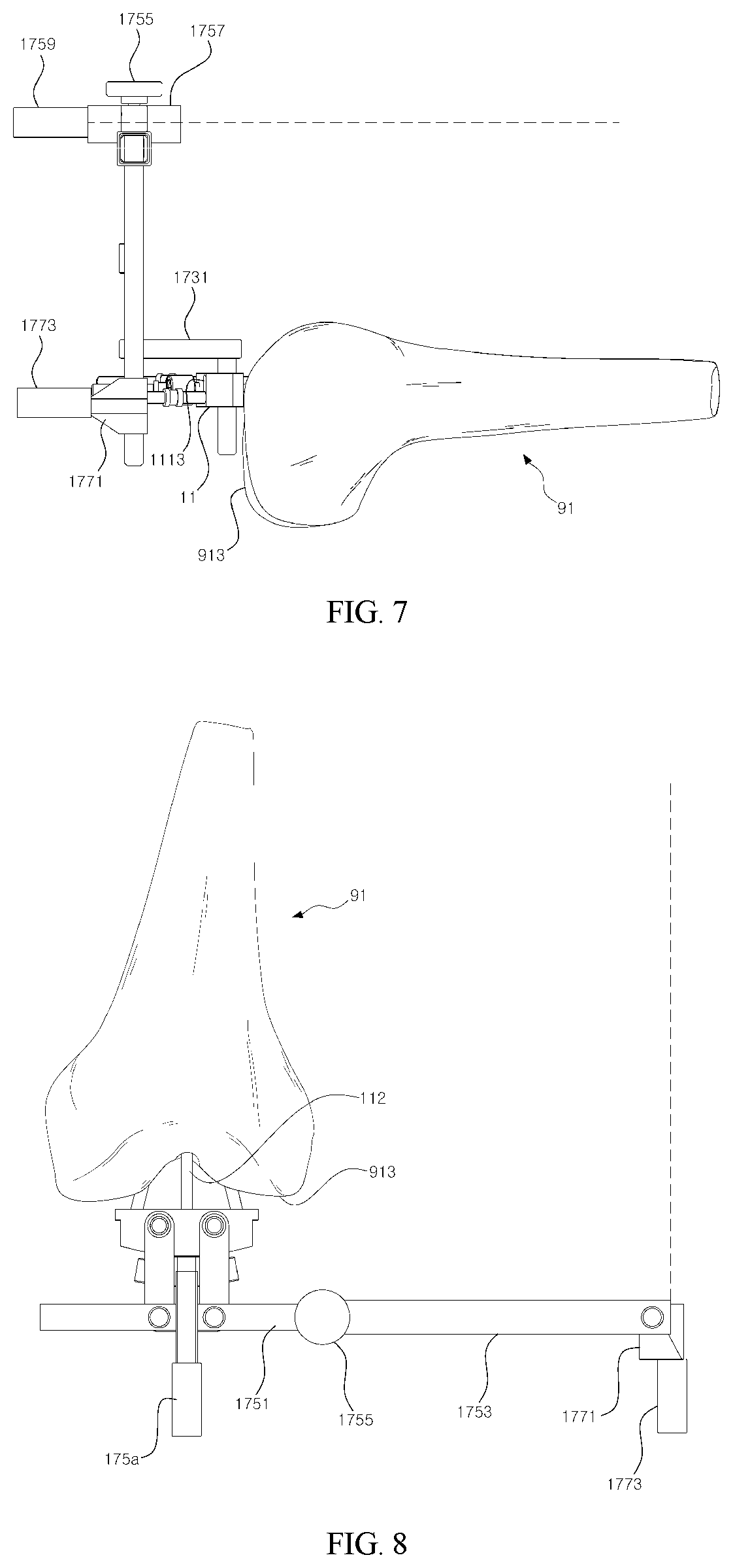 Patent US11779357 Figure 4 – Detector for artificial joint replacement