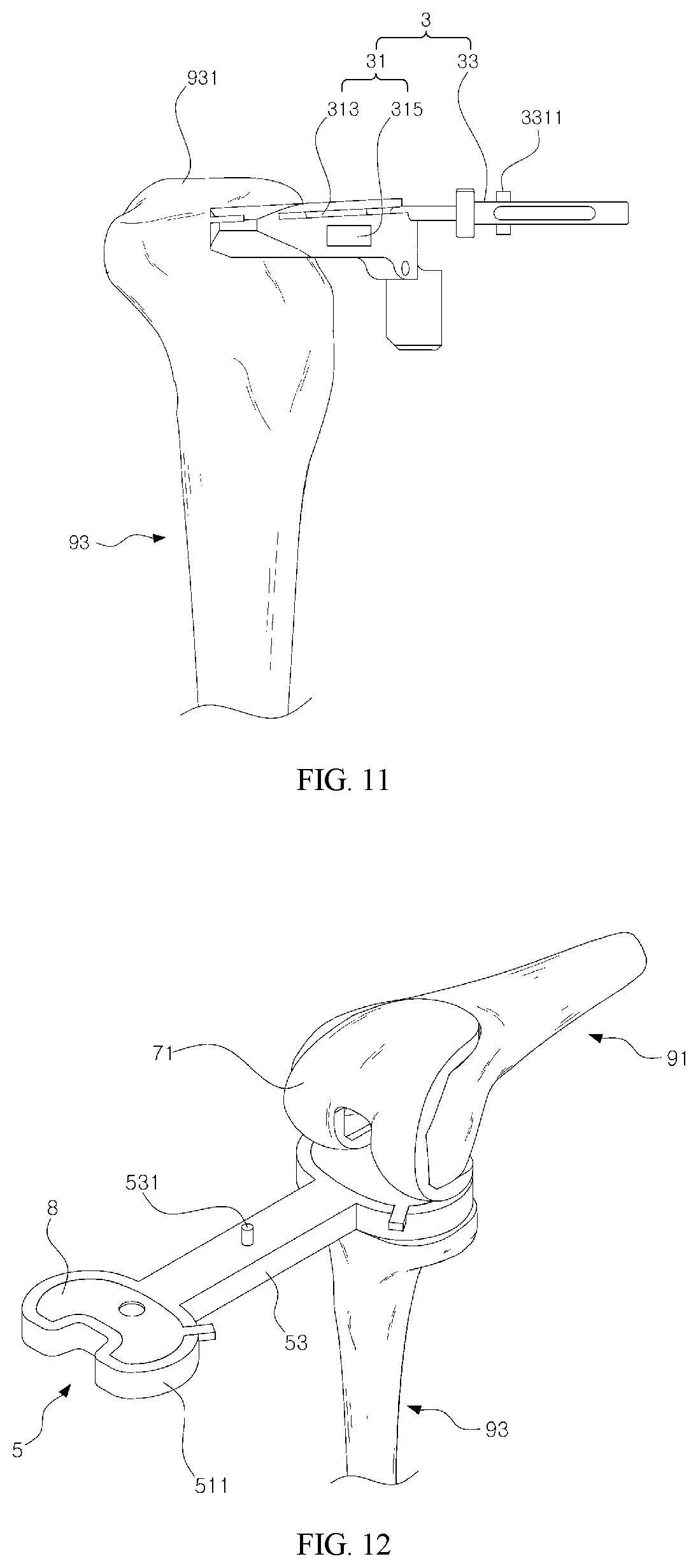 Patent US11779357 Figure 6 – Detector for artificial joint replacement