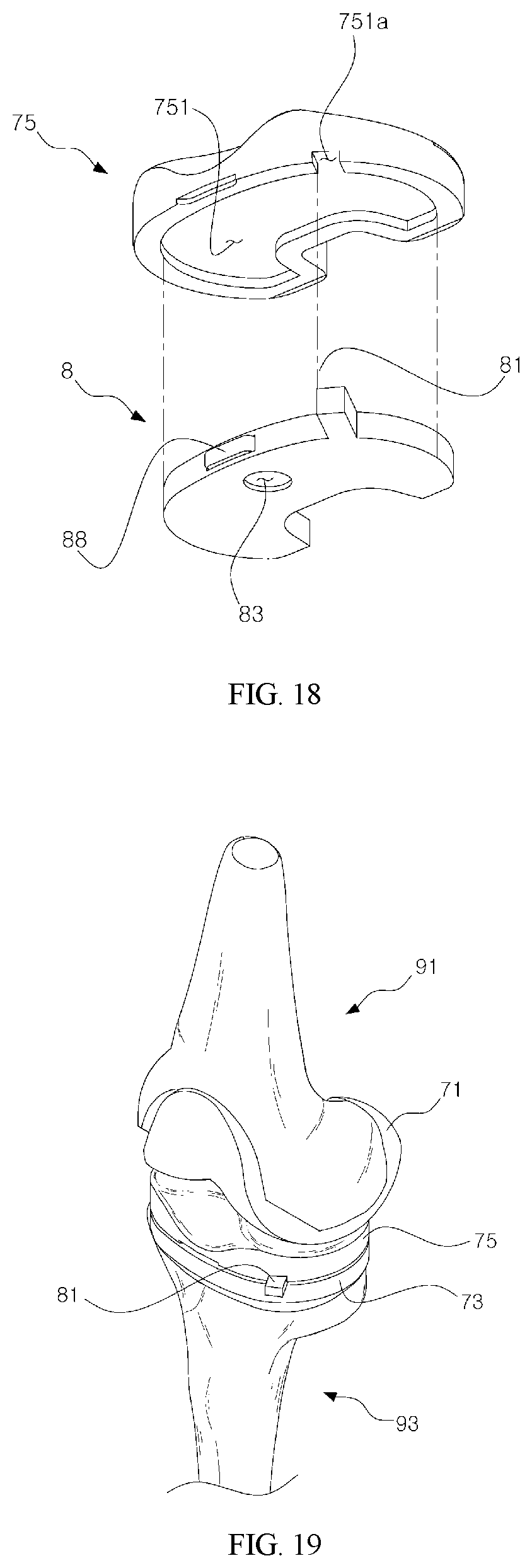 Patent US11779357 Figure 10 – Detector for artificial joint replacement