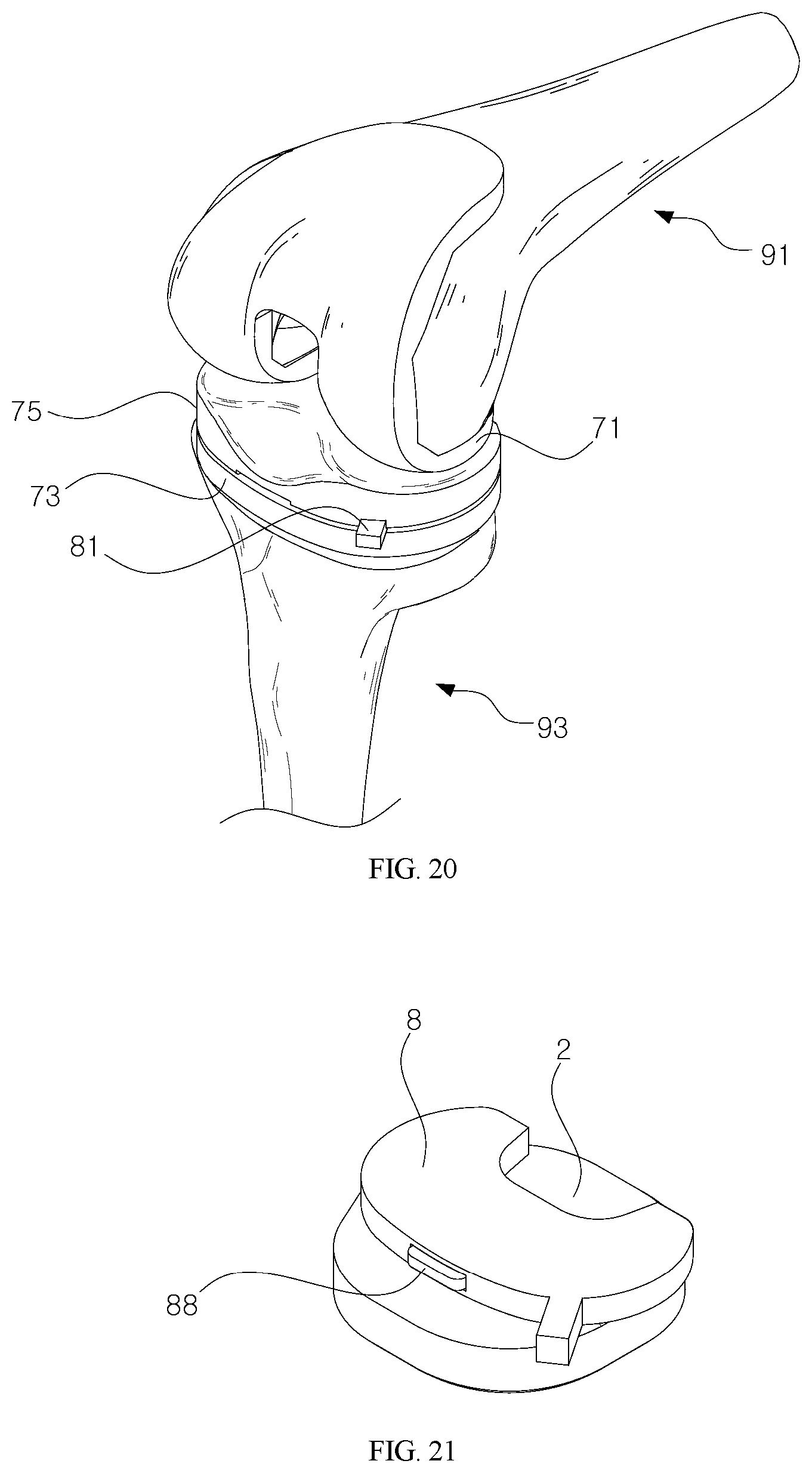 Patent US11779357 Figure 11 – Detector for artificial joint replacement