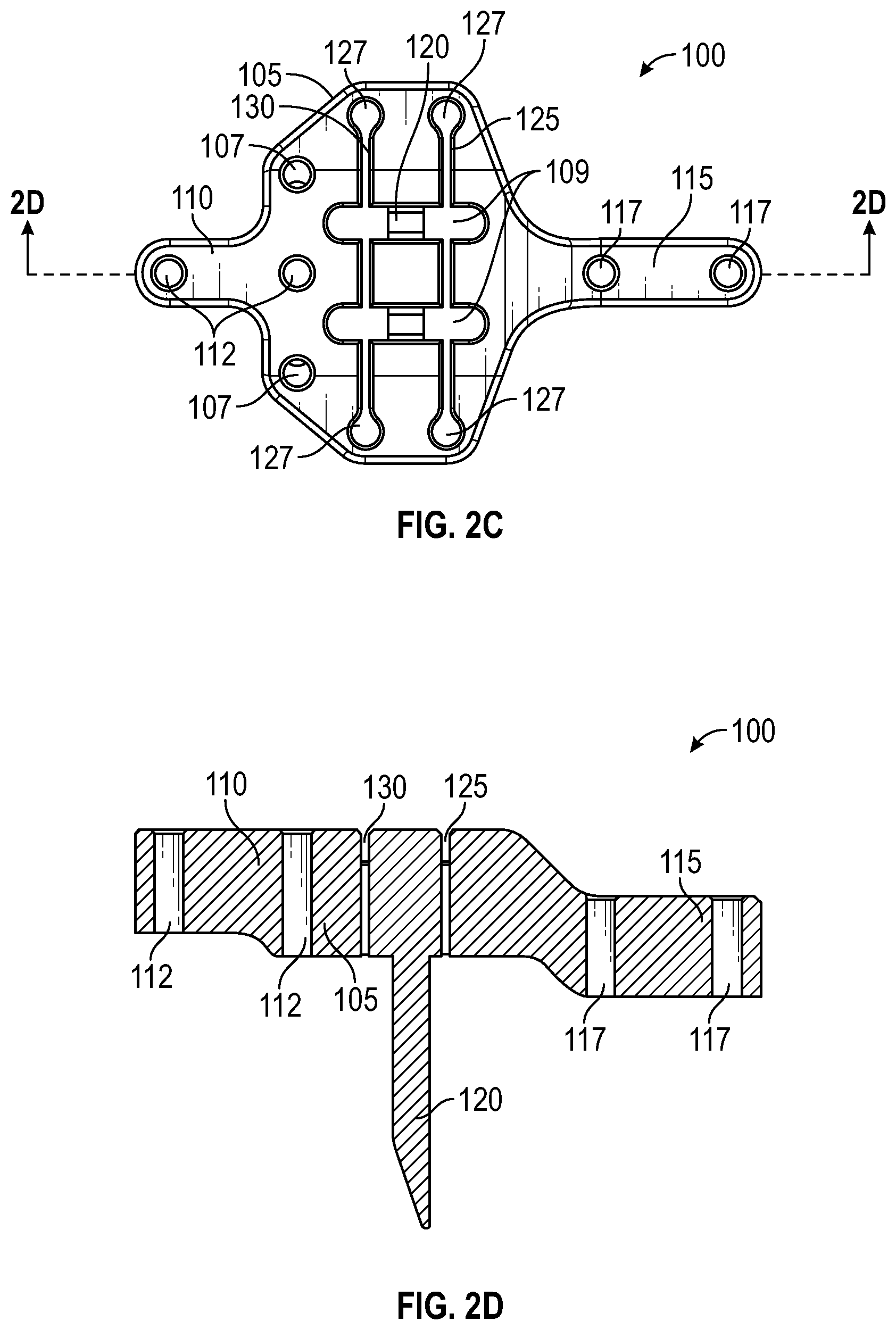 Patent US11779359 Figure 3 – Systems and methods for Lapidus repair of bunions