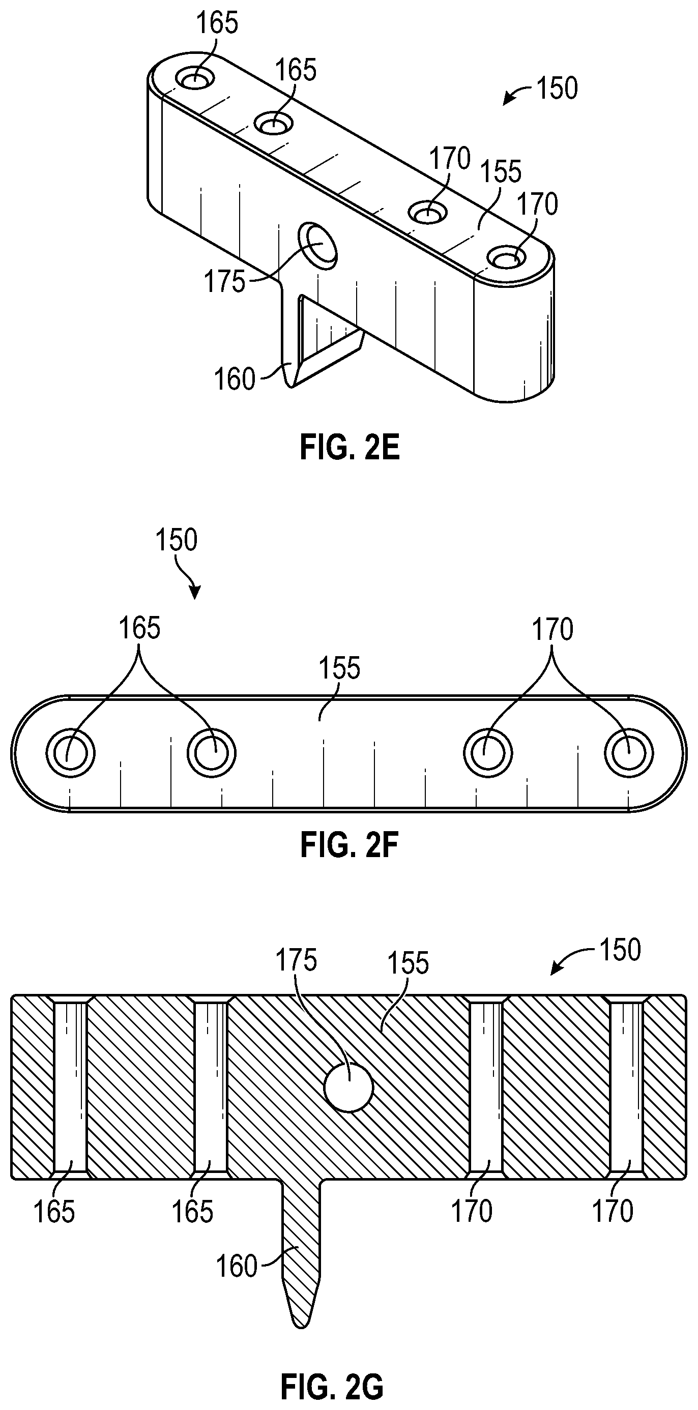 Patent US11779359 Figure 4 – Systems and methods for Lapidus repair of bunions
