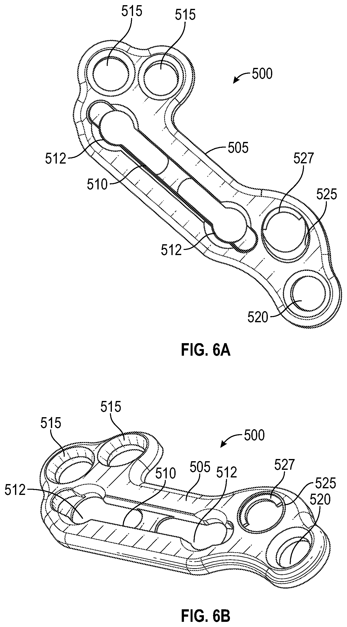 Patent US11779359 Figure 15 – Systems and methods for Lapidus repair of bunions