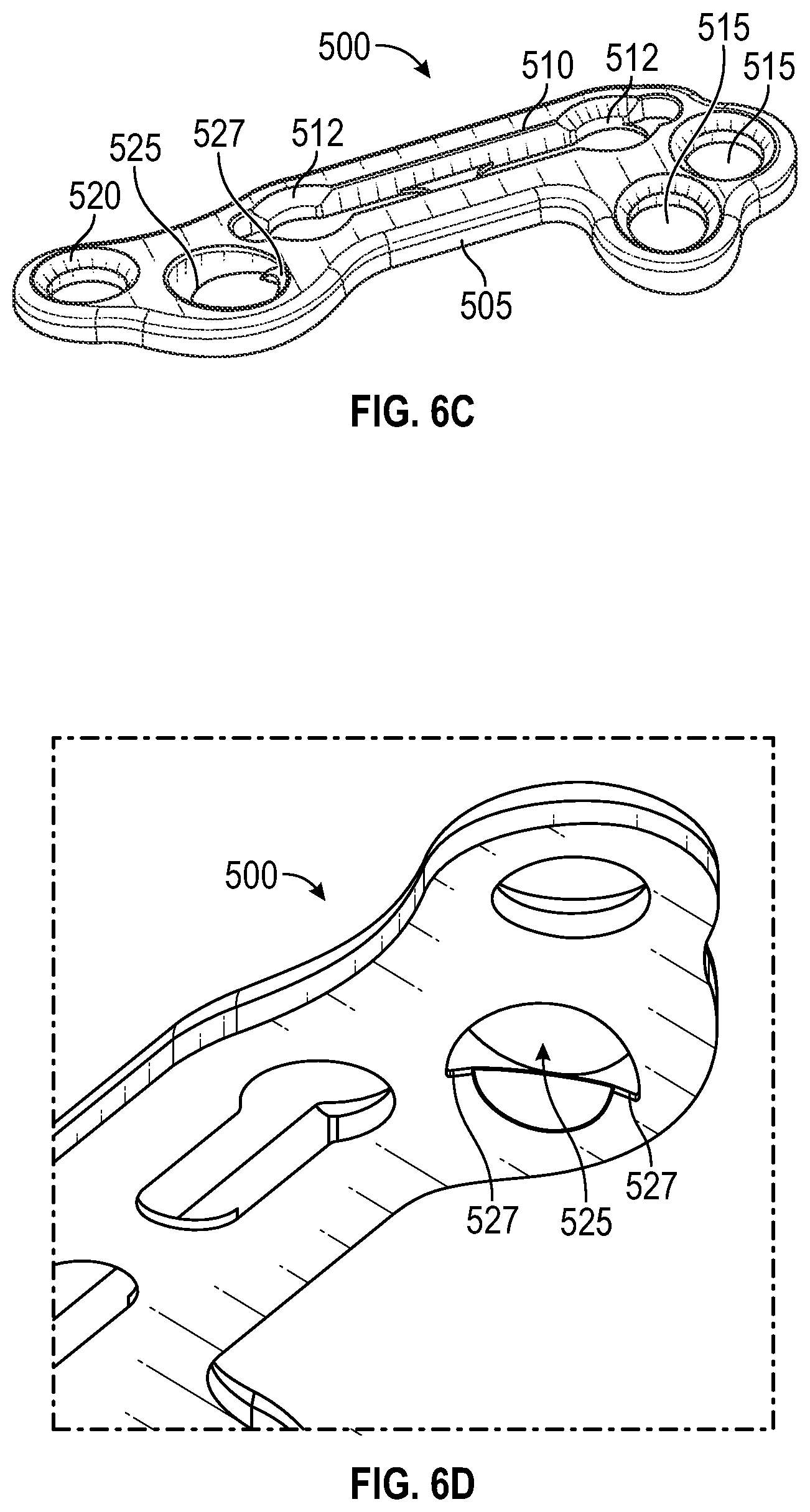 Patent US11779359 Figure 16 – Systems and methods for Lapidus repair of bunions