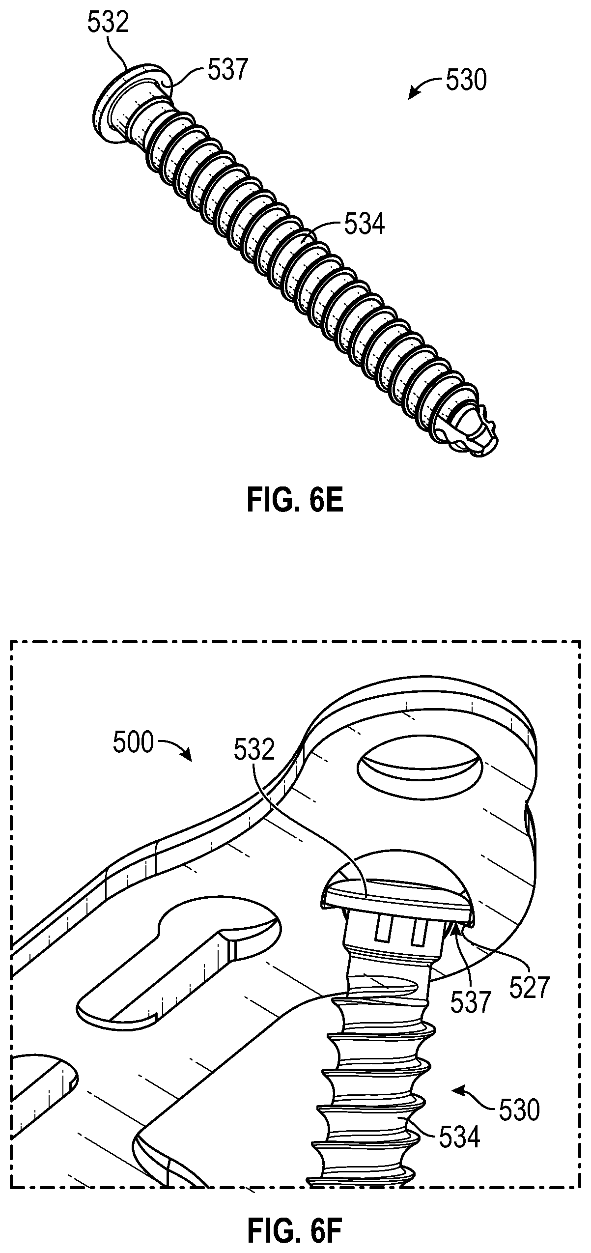 Patent US11779359 Figure 17 – Systems and methods for Lapidus repair of bunions