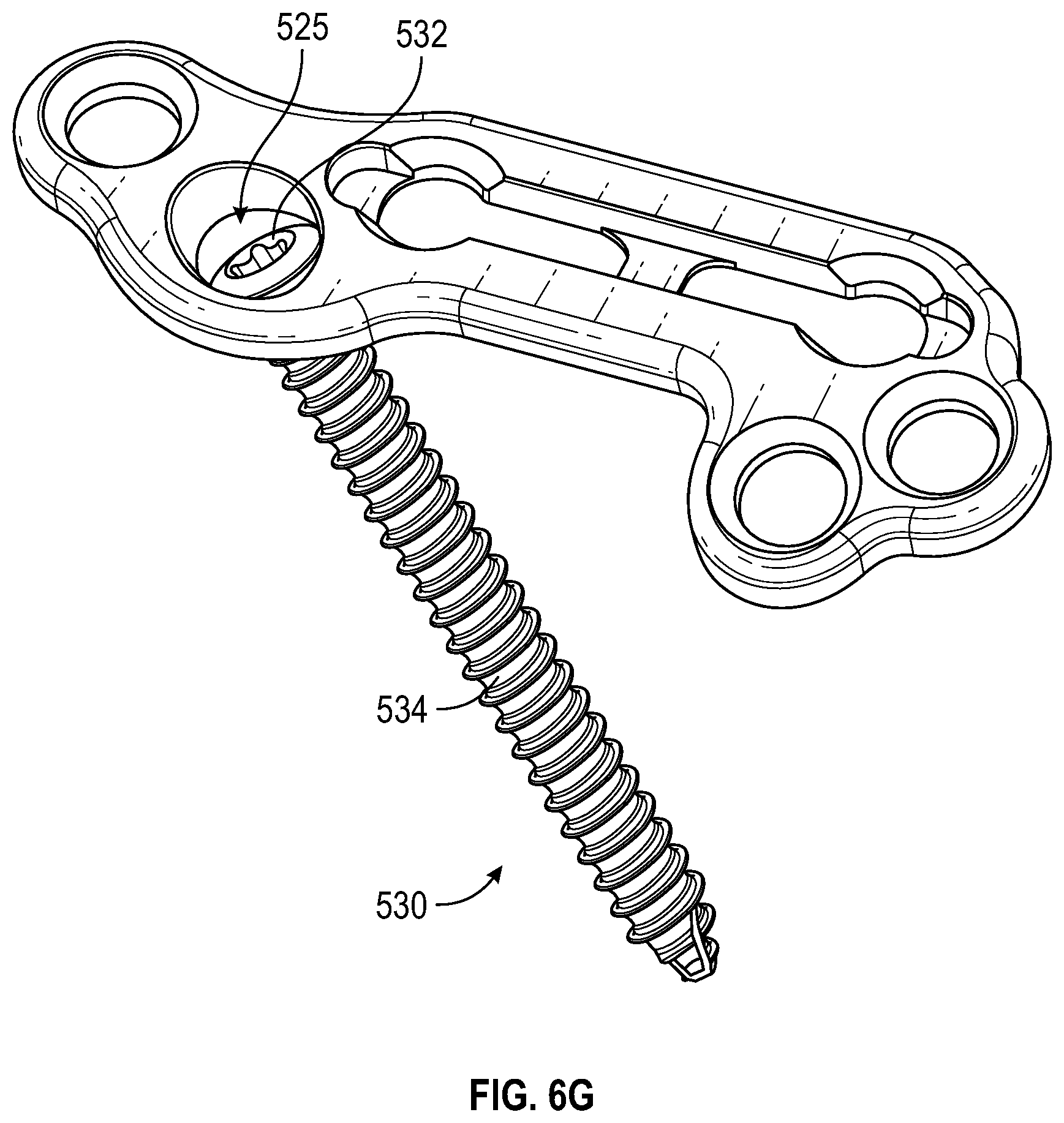Patent US11779359 Figure 18 – Systems and methods for Lapidus repair of bunions